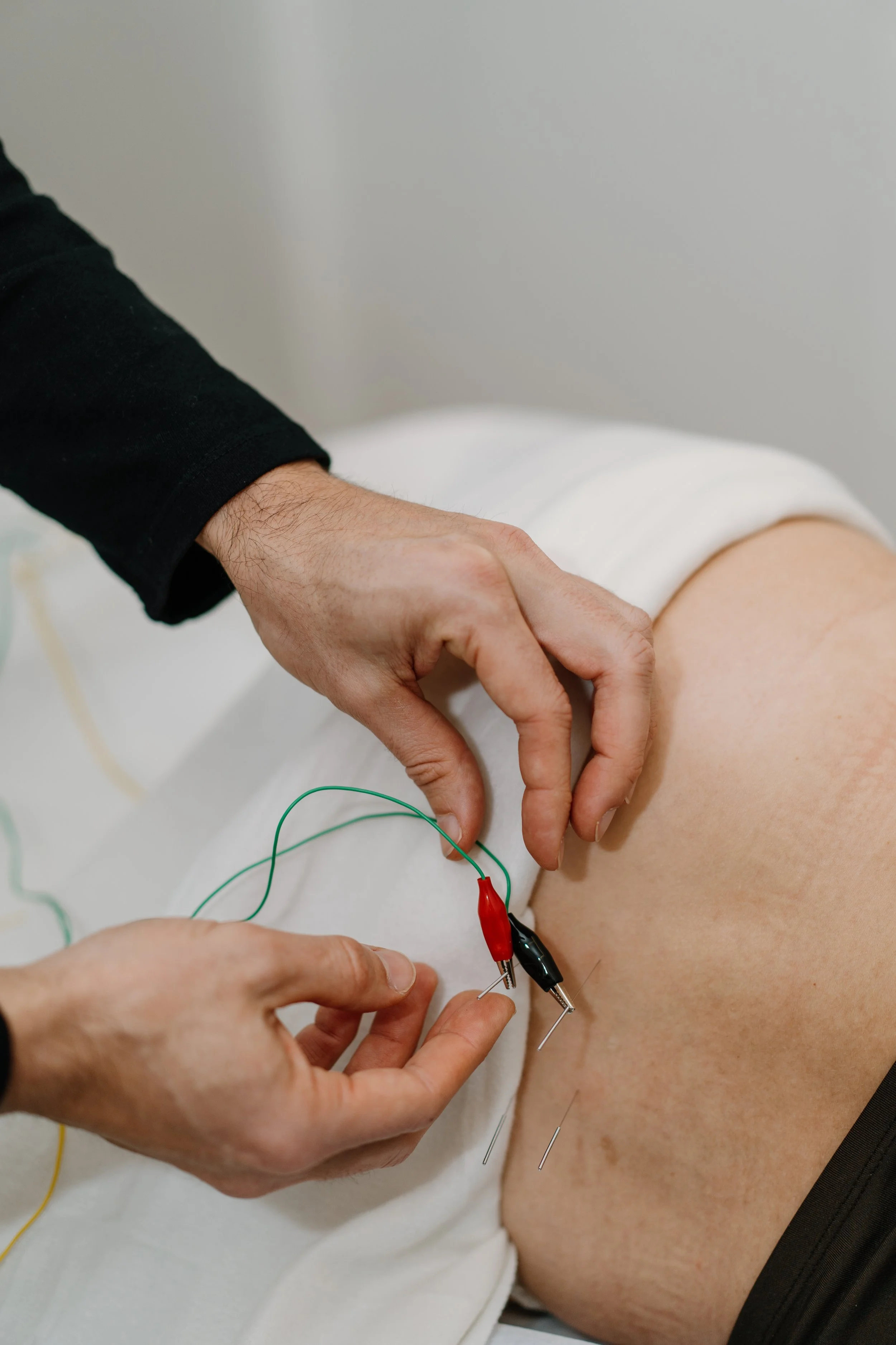 meraki-acupuncture-tcm-treatment-lagos-luz-algarve-portugal