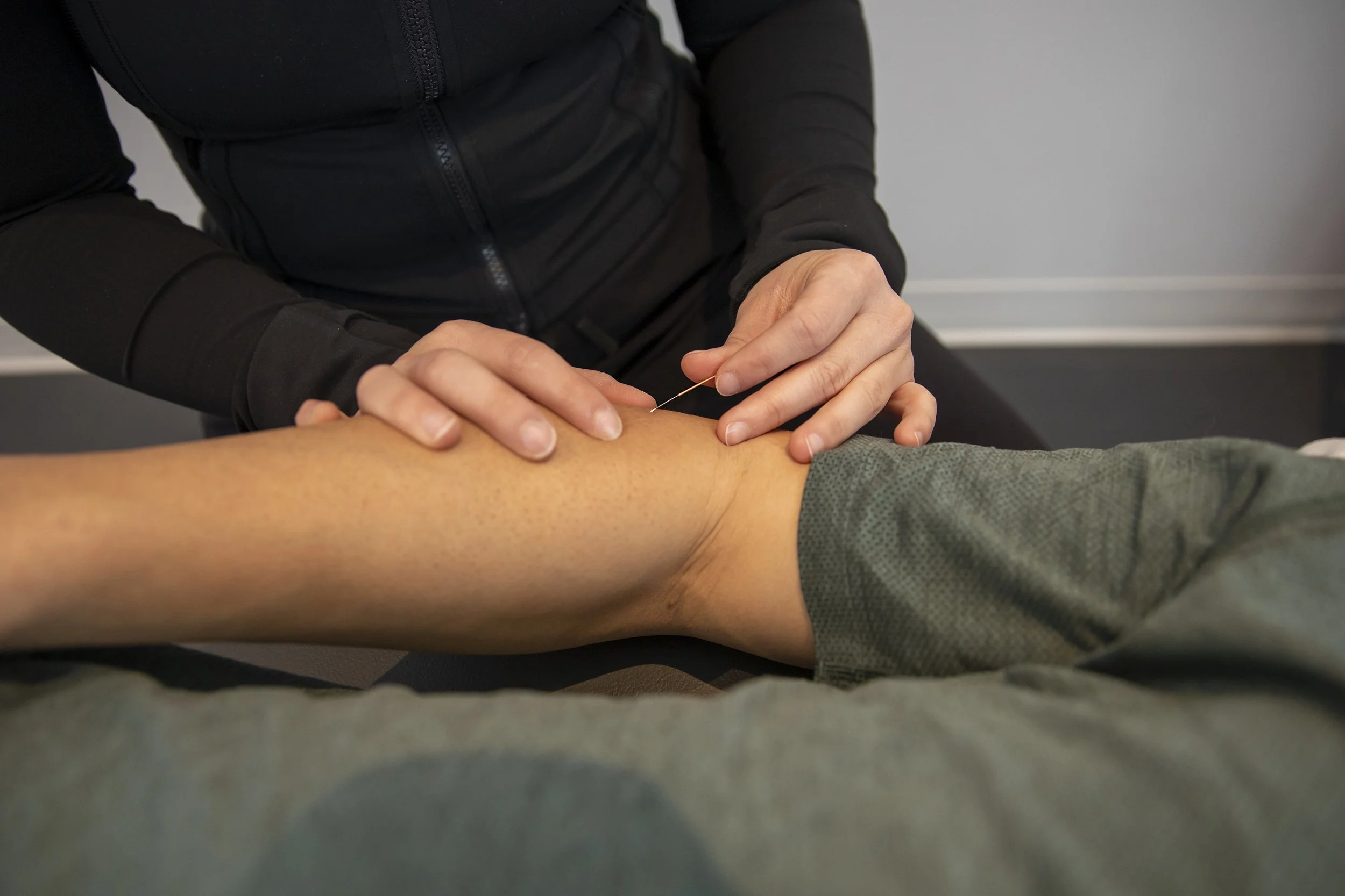 Une personne en train de pratiquer l'acupuncture sur la jambe d'un patient, insérant une fine aiguille.