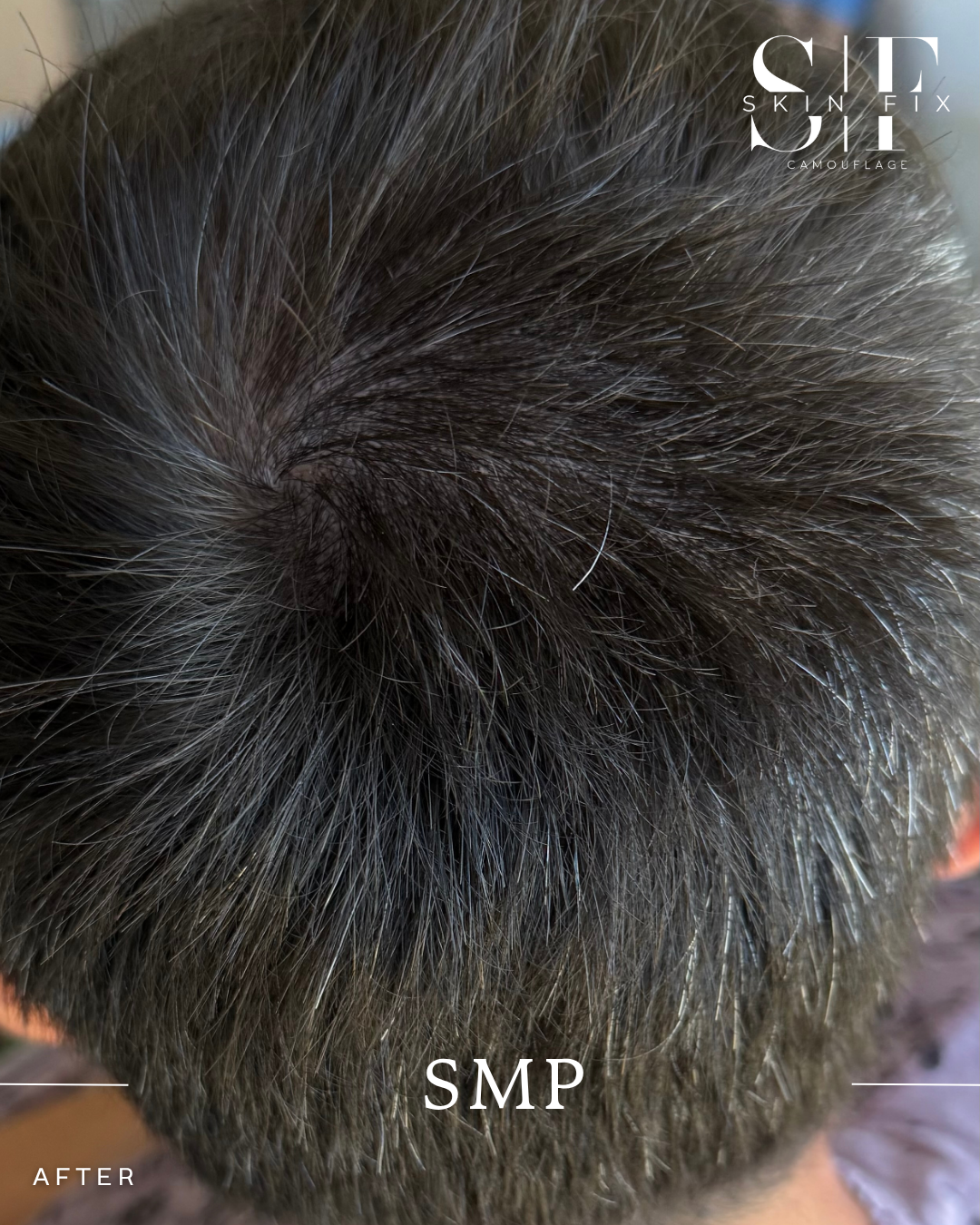 smp  - 3.PNG