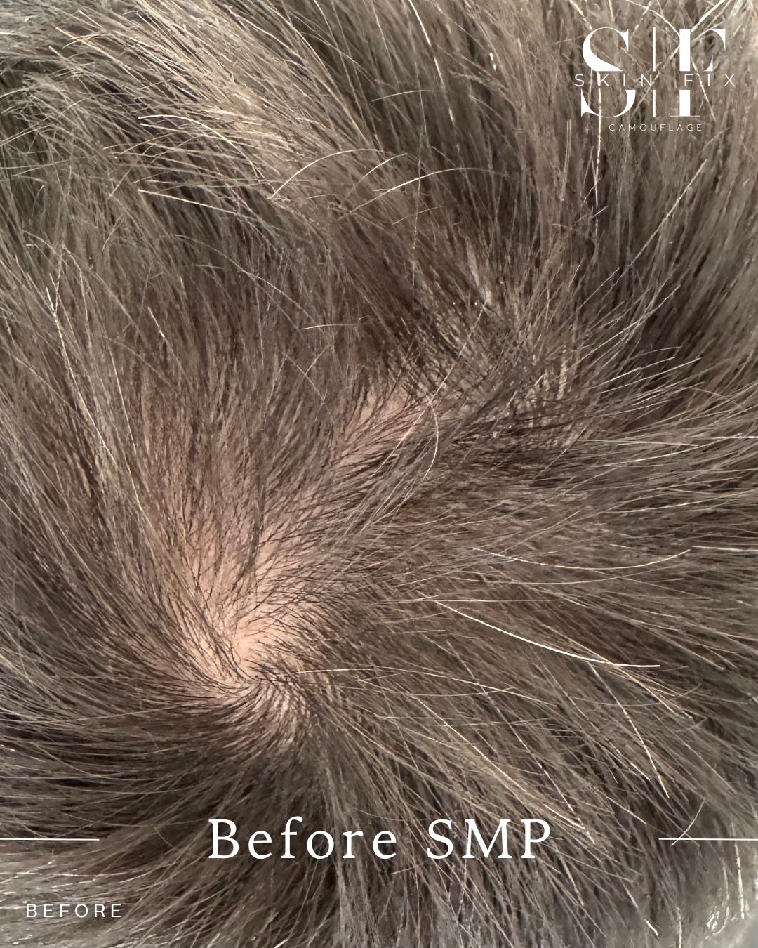 smp  - 2.PNG