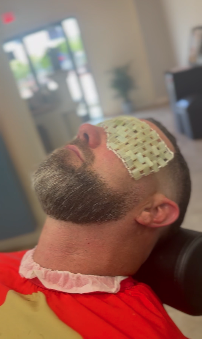 A man with a beard and a buzz cut lying back with a medical patch over his closed eye in a clinical or spa setting.