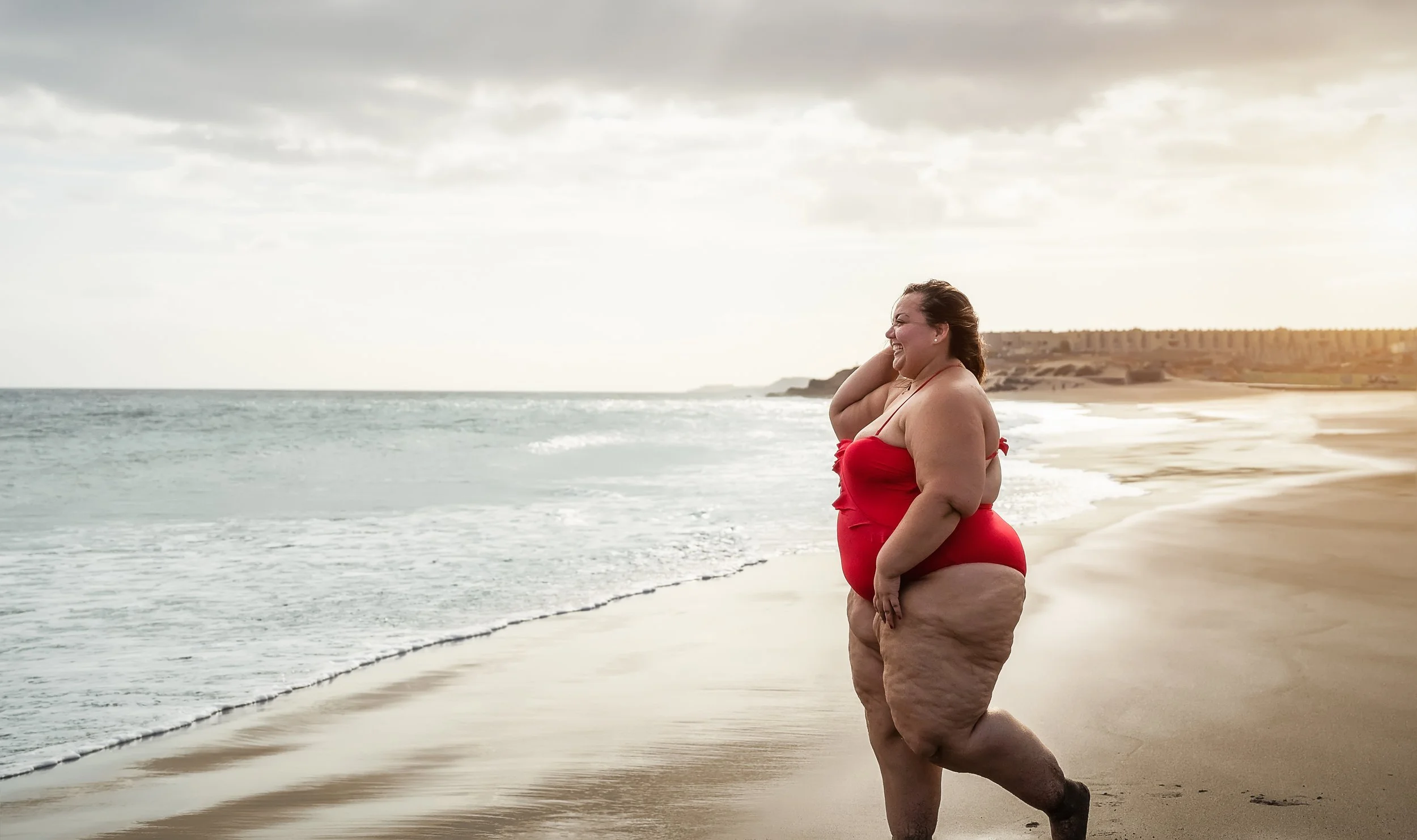 Lipoedème / Lipoedema