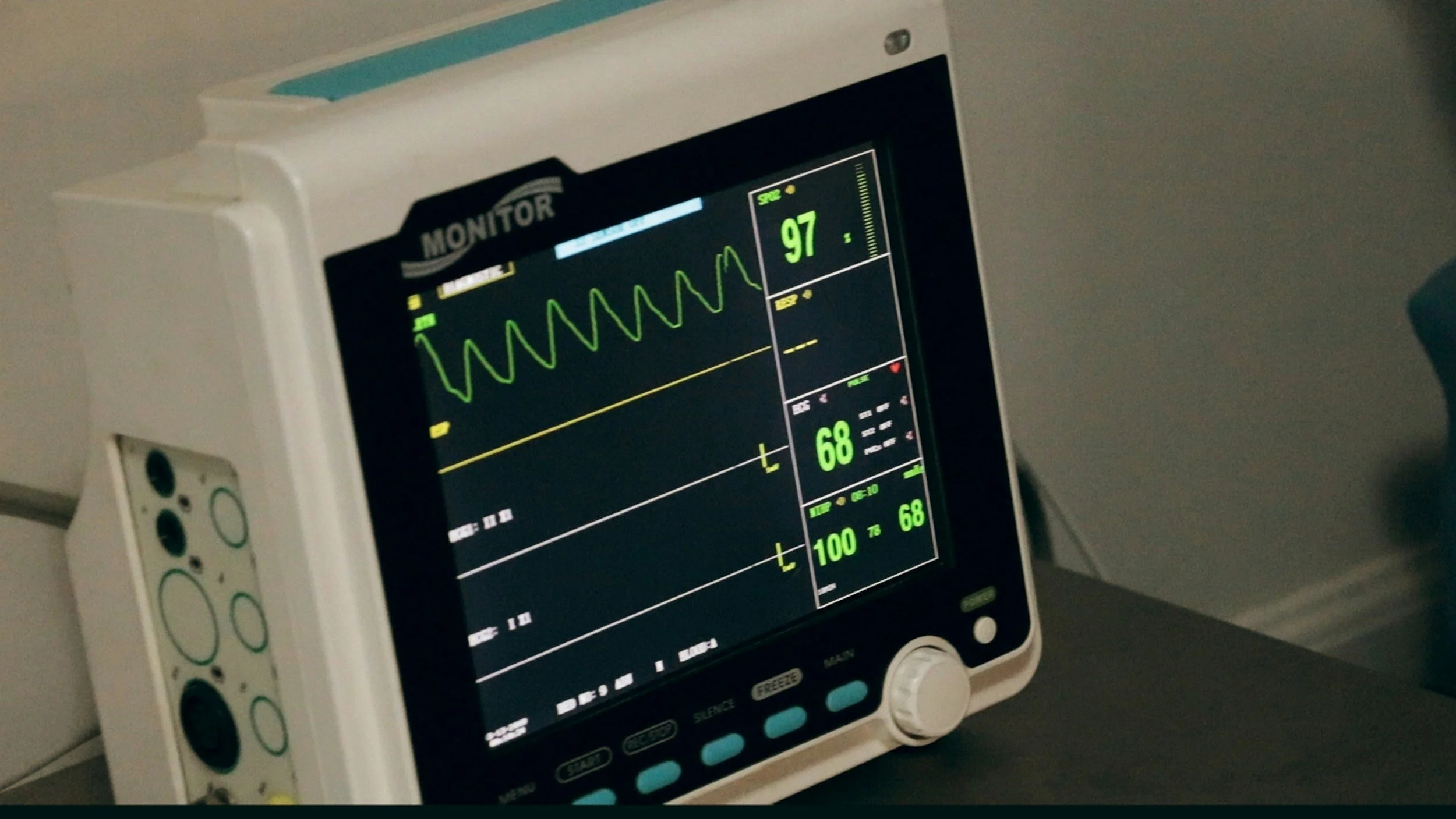 A medical monitor screen displaying vital signs including heart rate, oxygen saturation, and blood pressure.