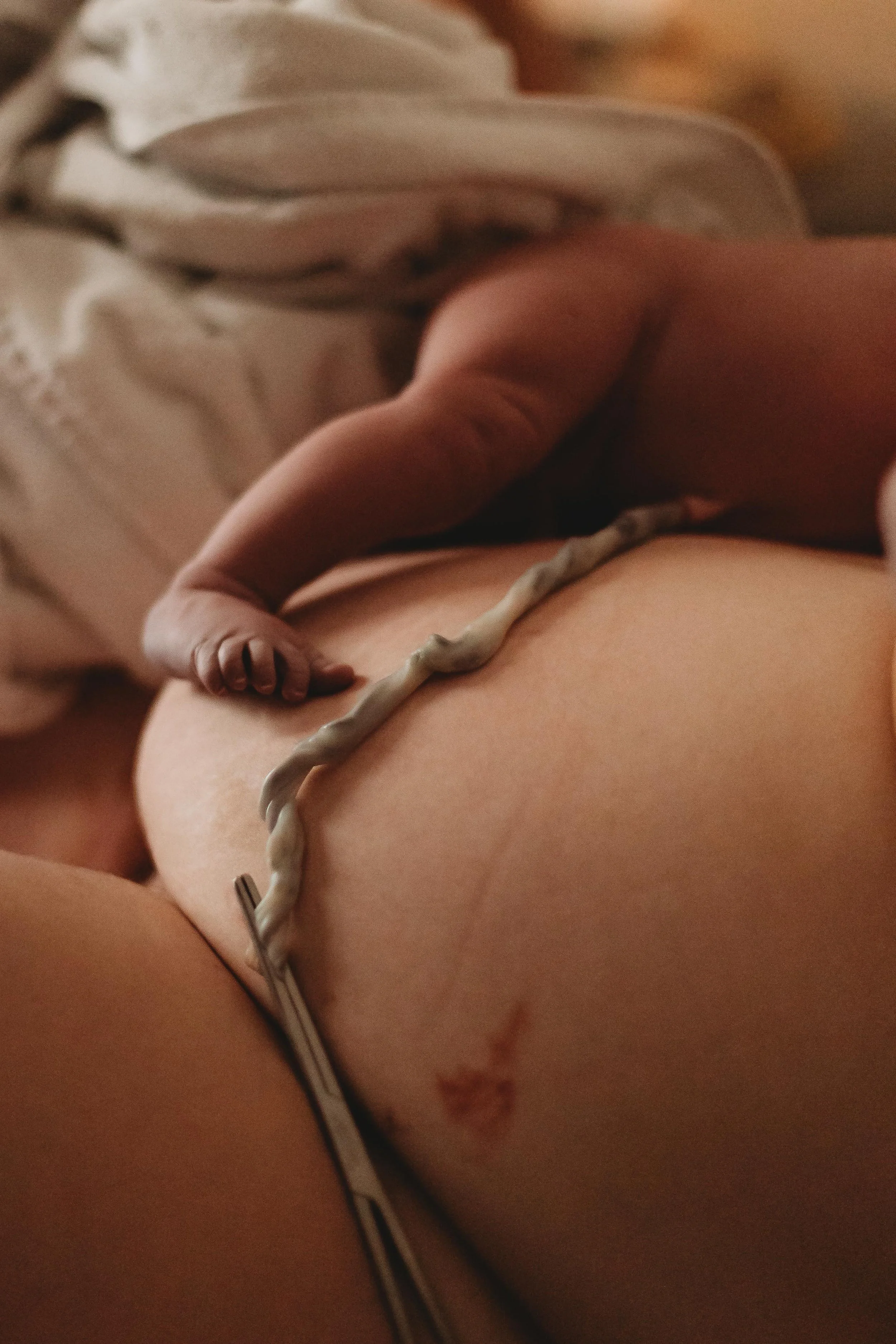 Birth photography  - new baby on mothers stomach