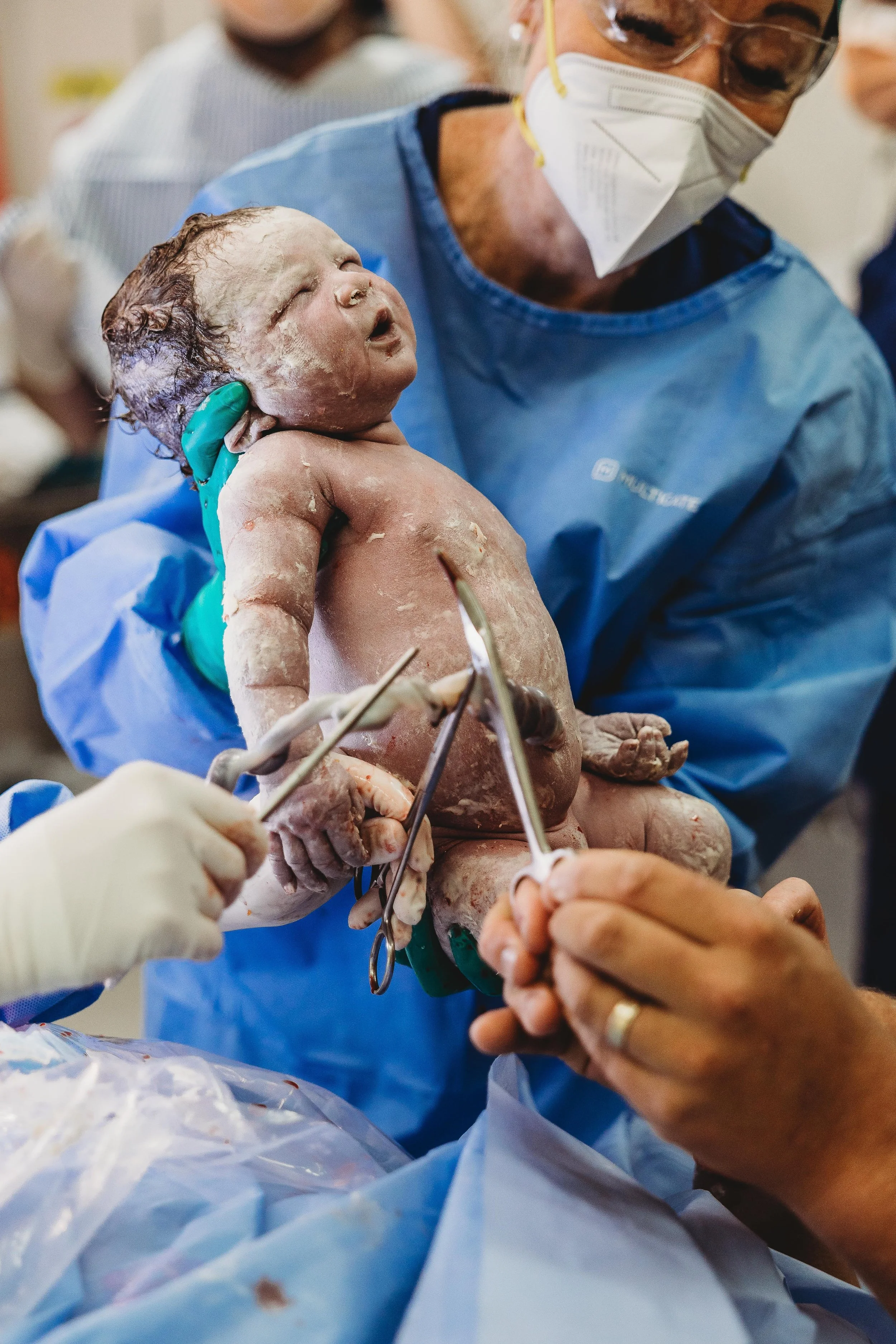 birth photograph - baby being born in Surrey