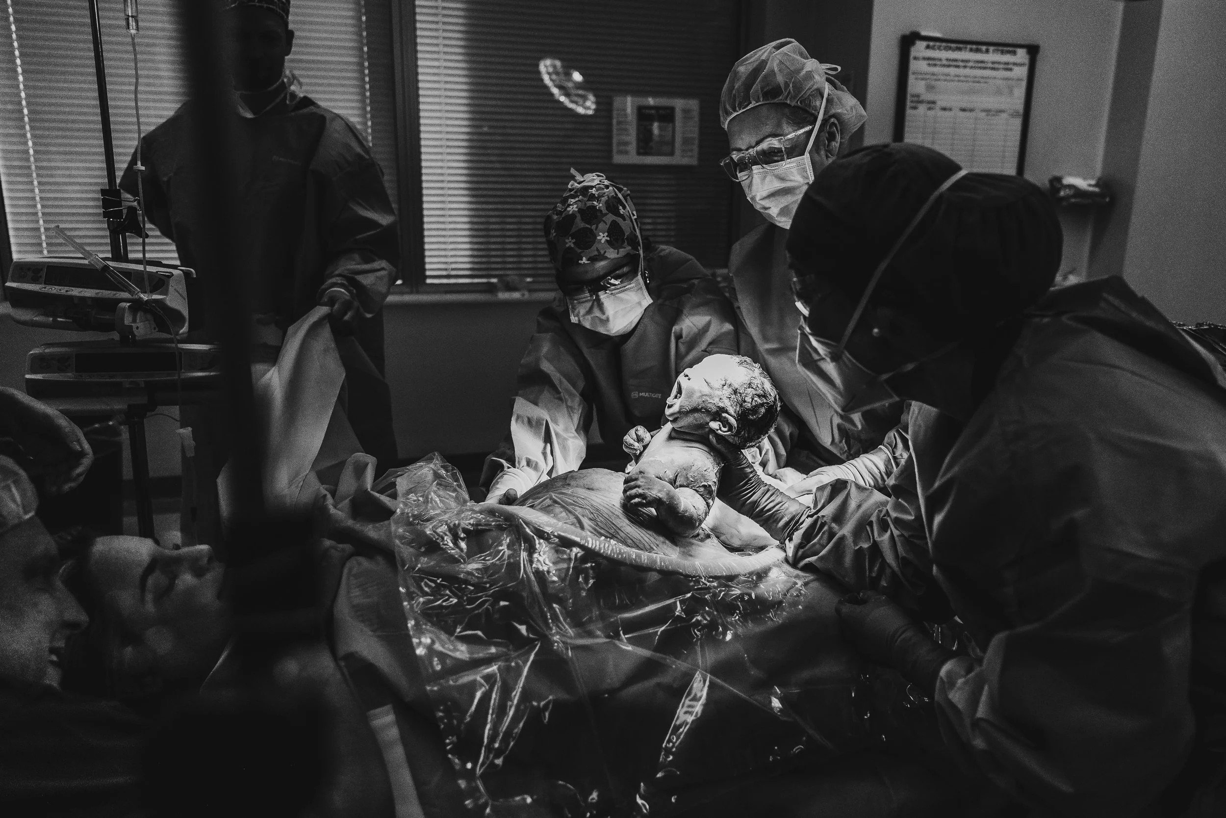 baby being born in surgery