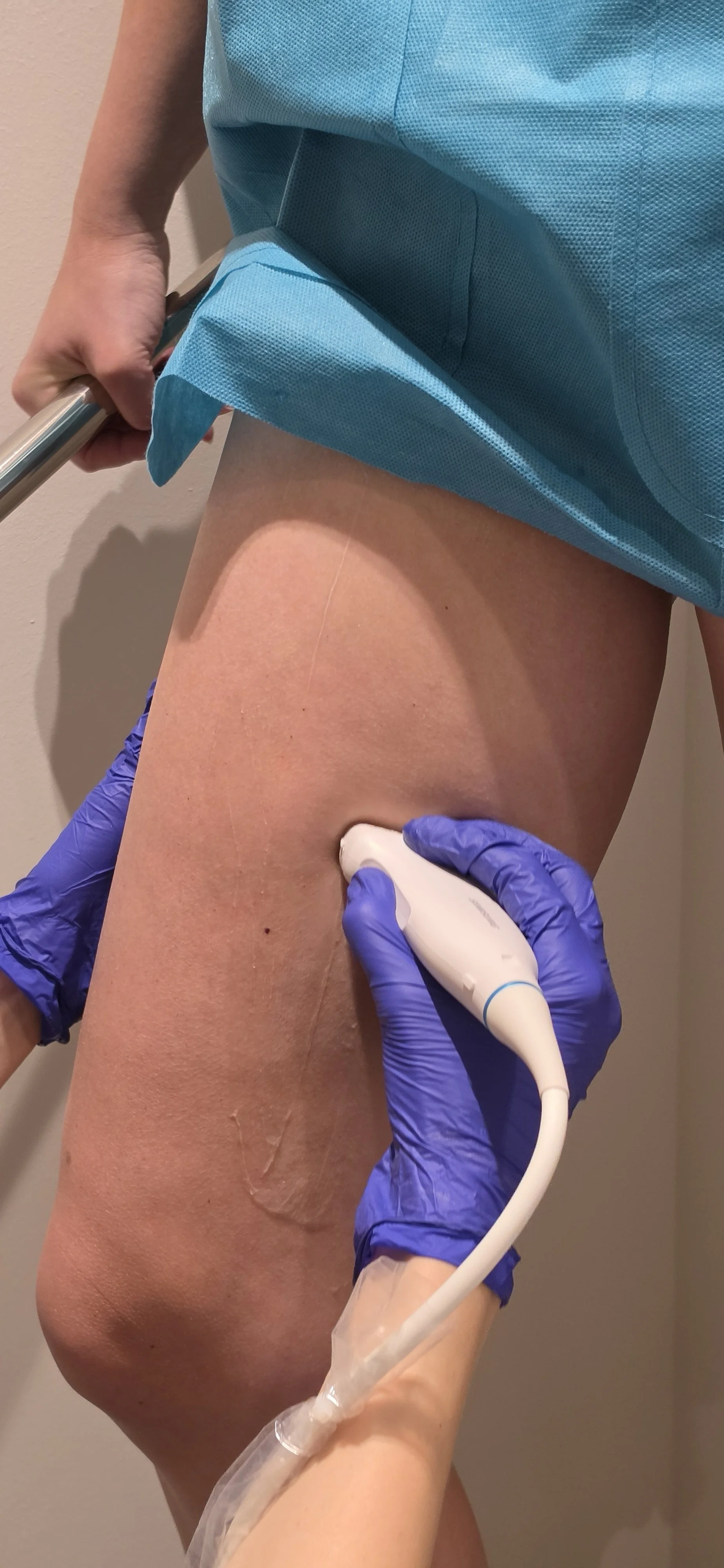 USG Doppler tętnic i żył kończyn dolnych
