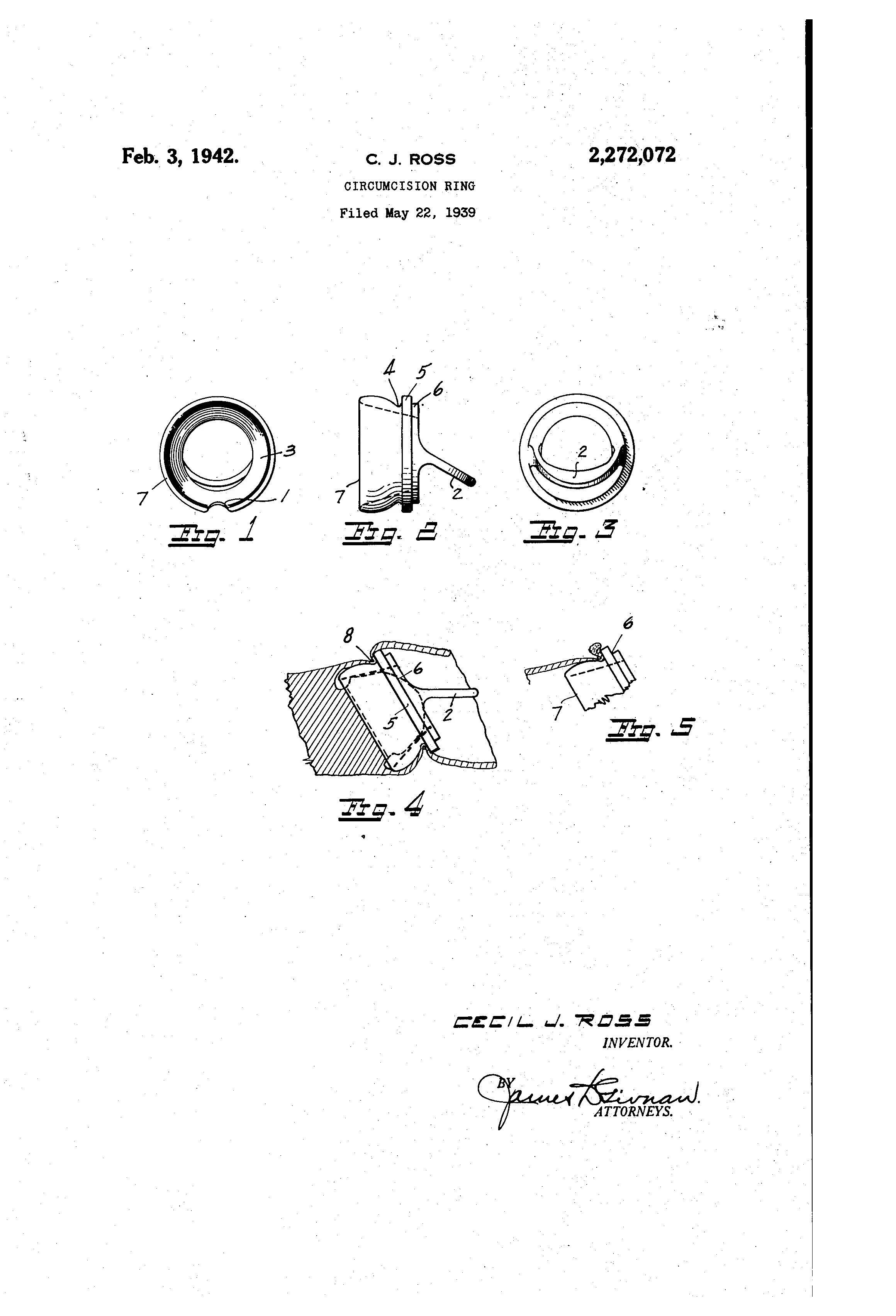 Patent document for a circumcision ring filed on May 22, 1939, with technical diagrams showing different views and details of the device.