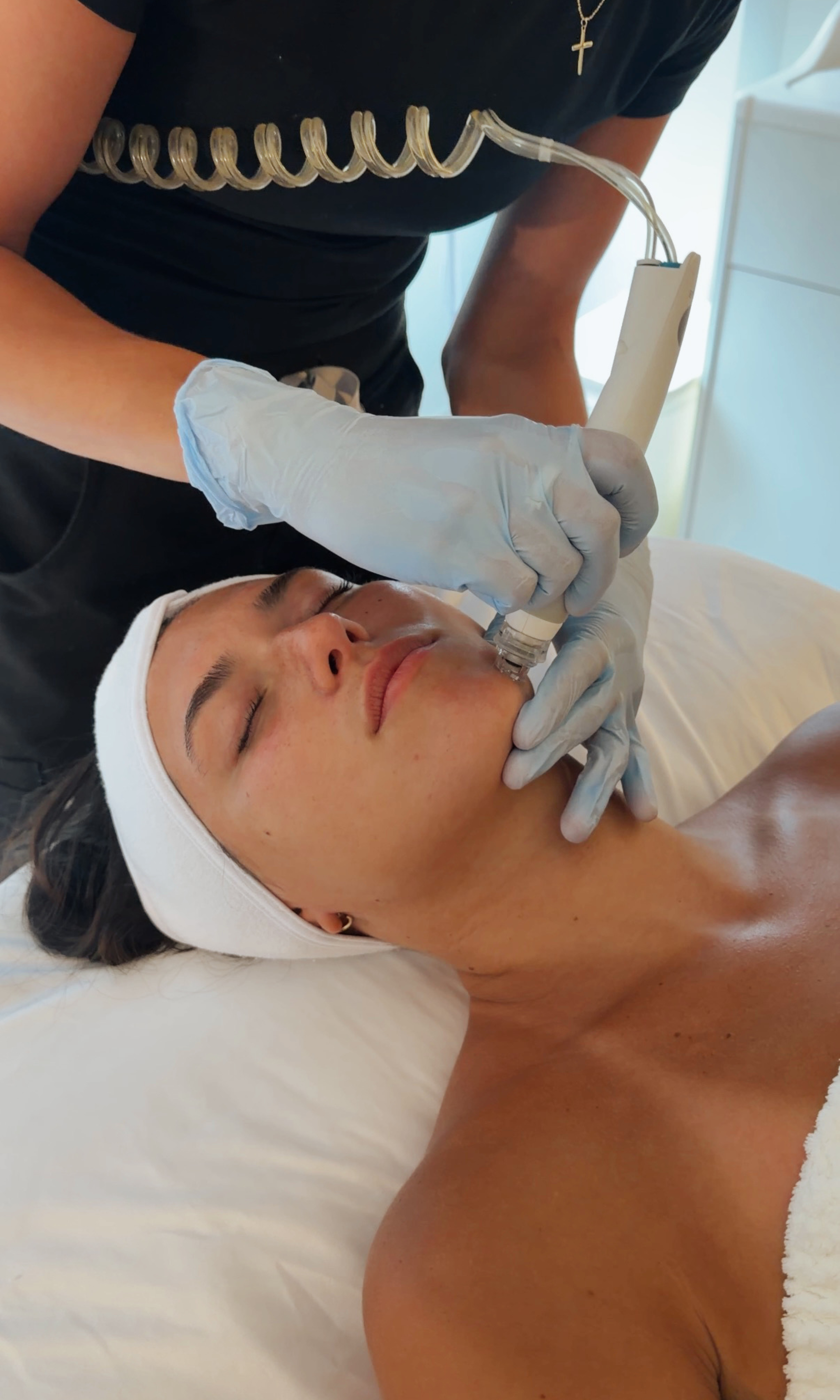 Medspa in Northbrook, IL, 60062 Microneedling Near Me