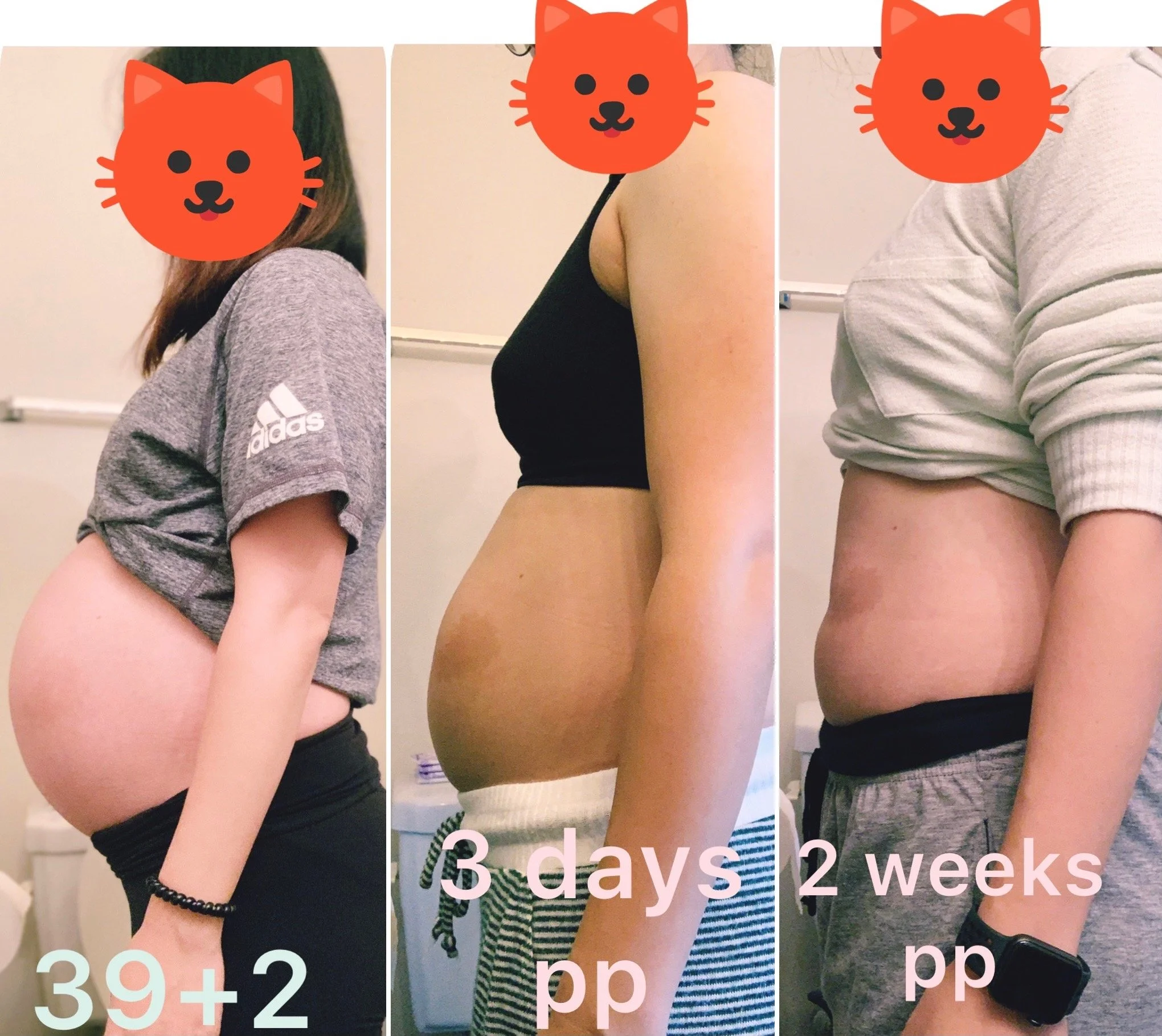 Postpartum fact-check series 1: Why do I still look pregnant even after labor?