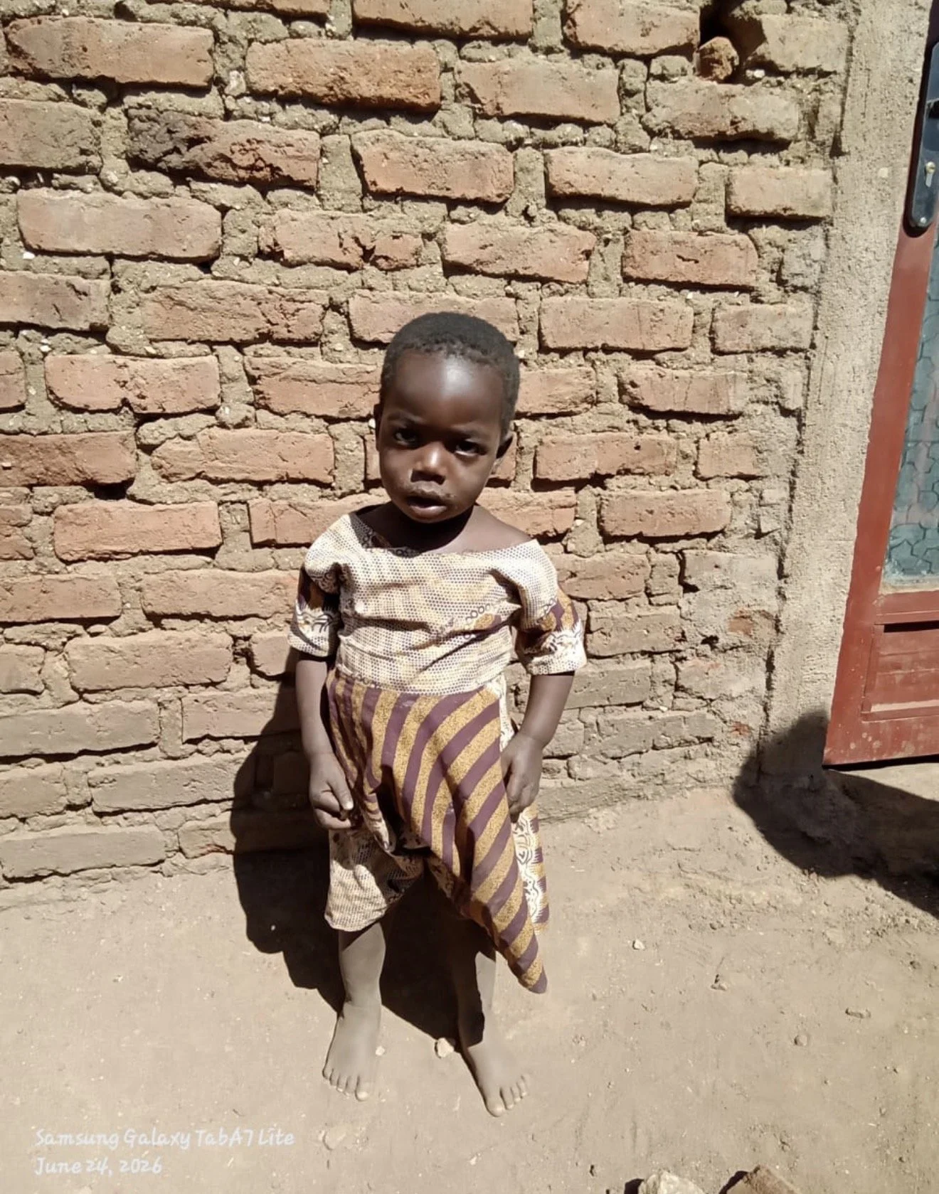 Shamim A, 2 year-old