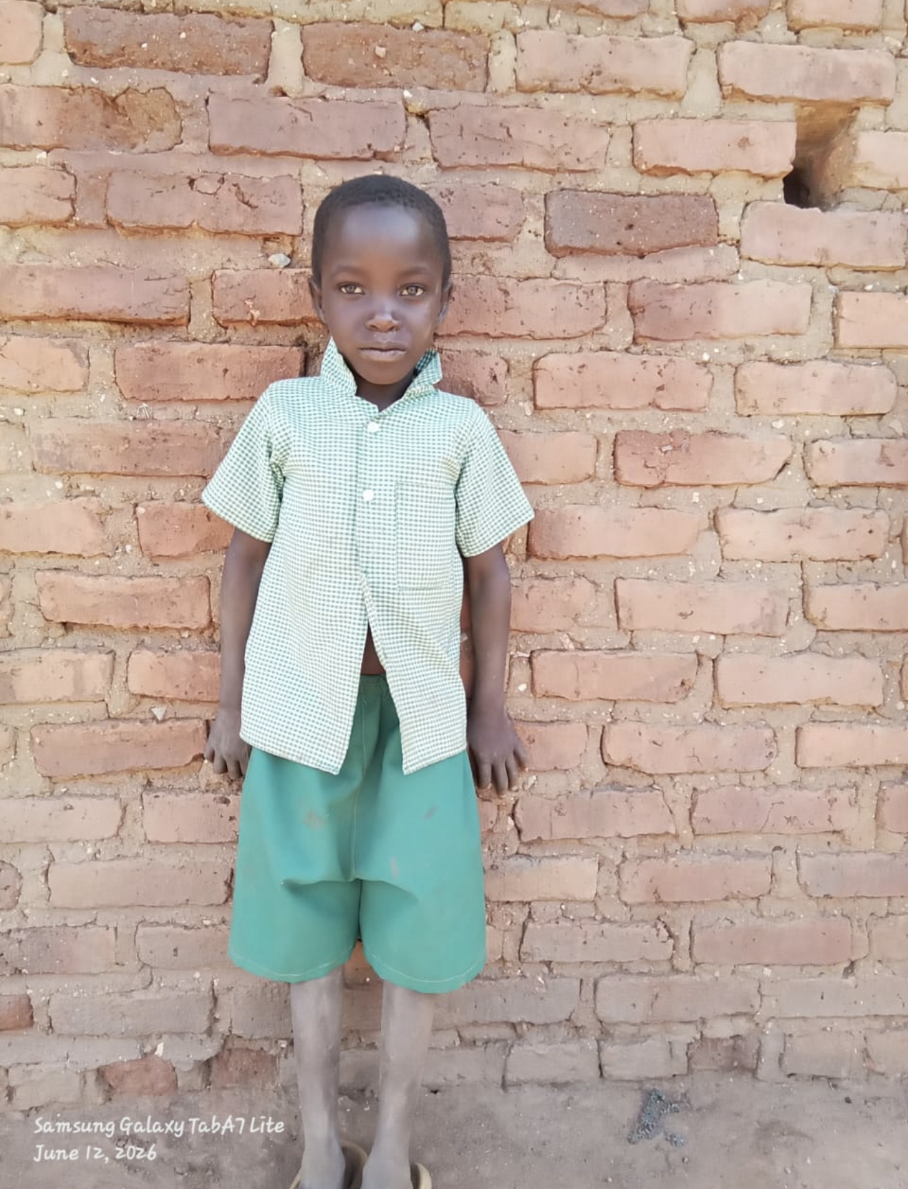 Apatsa A, 8 years old