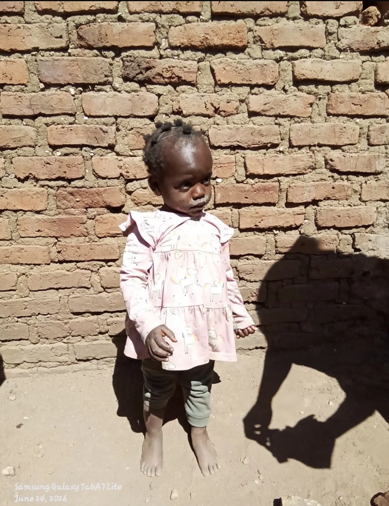 Alinafe B, 2 year-old