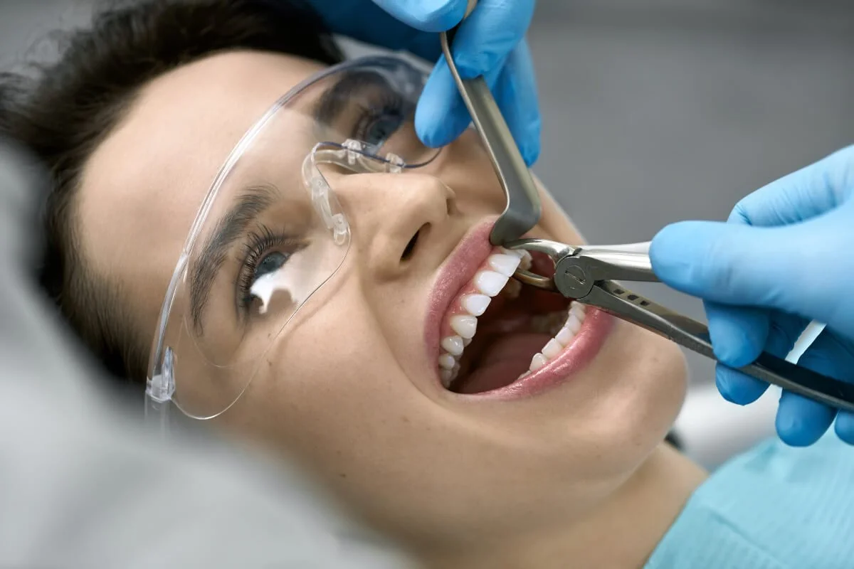 Extractions from $150