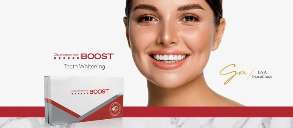 In-office Teeth Whitening
