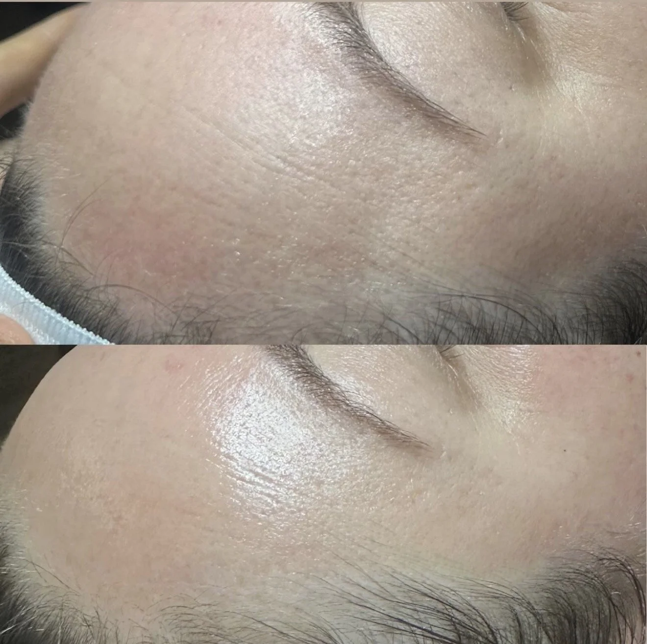 Luxury facial treatment