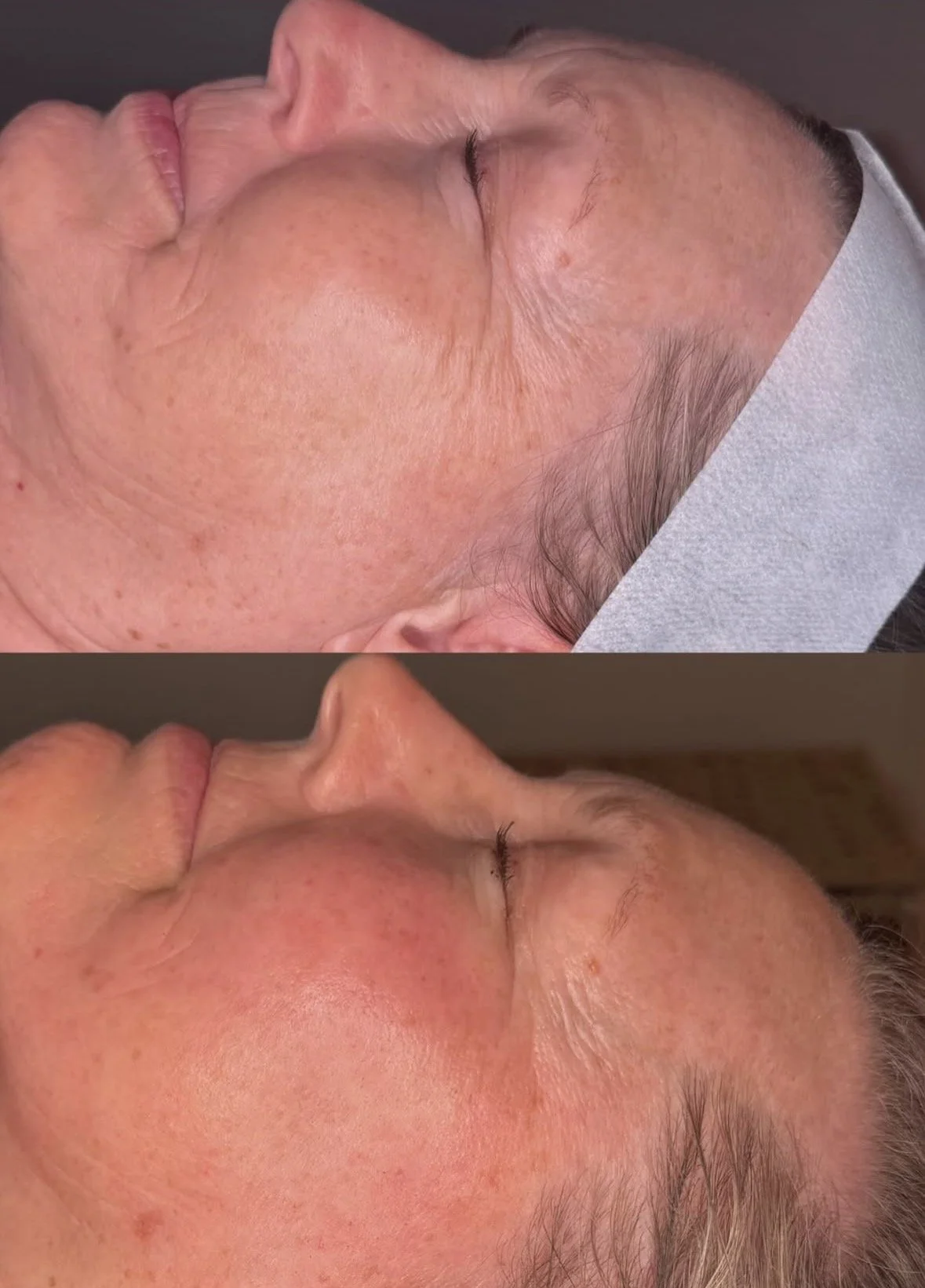 Facial spa treatment Shrewsbury, NJ