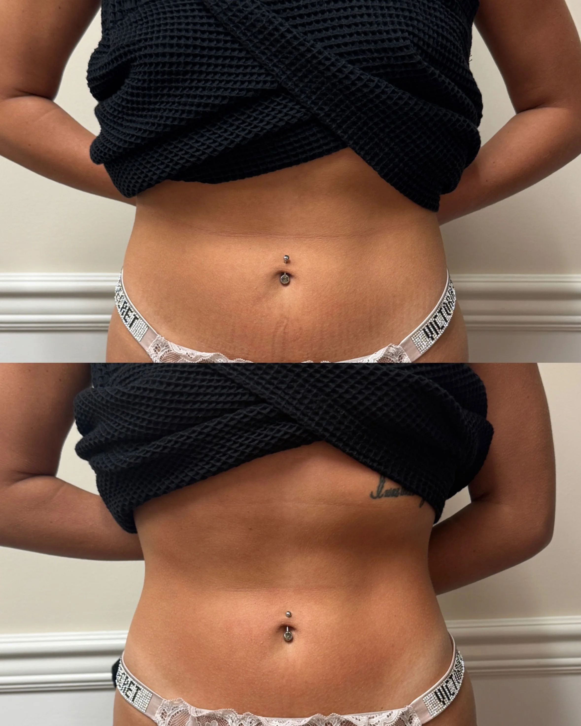 Lymphatic drainage massage