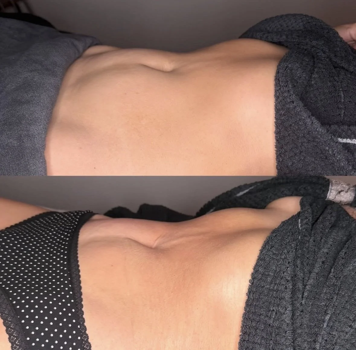 body sculpting Shrewsbury NJ
