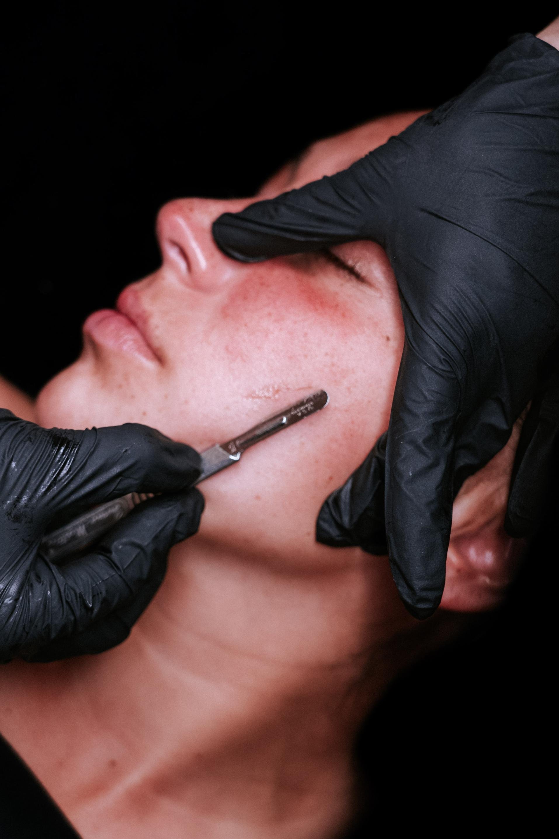Dermaplaning facial Shrewsbury, NJ