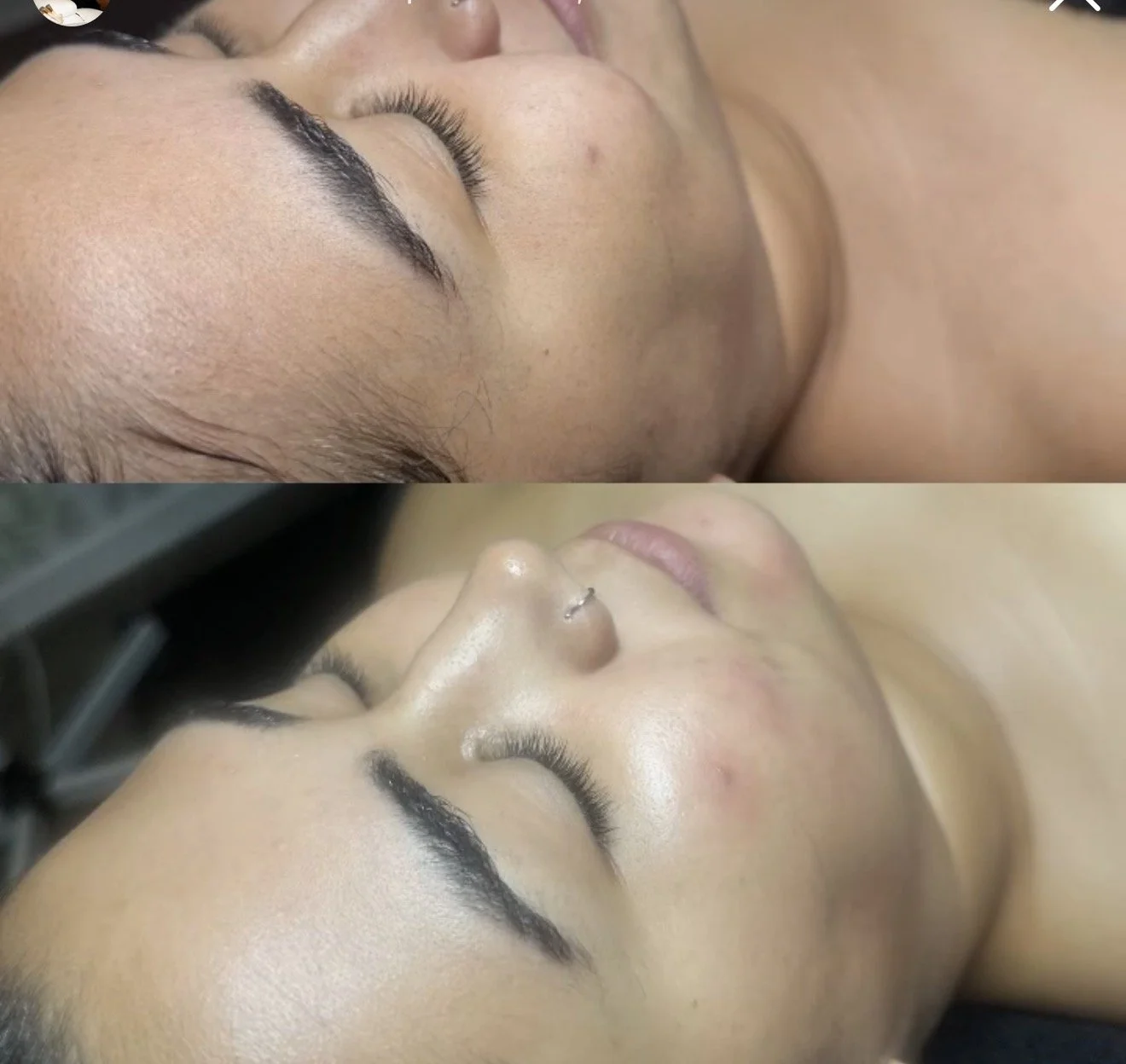 Luxury facial treatment