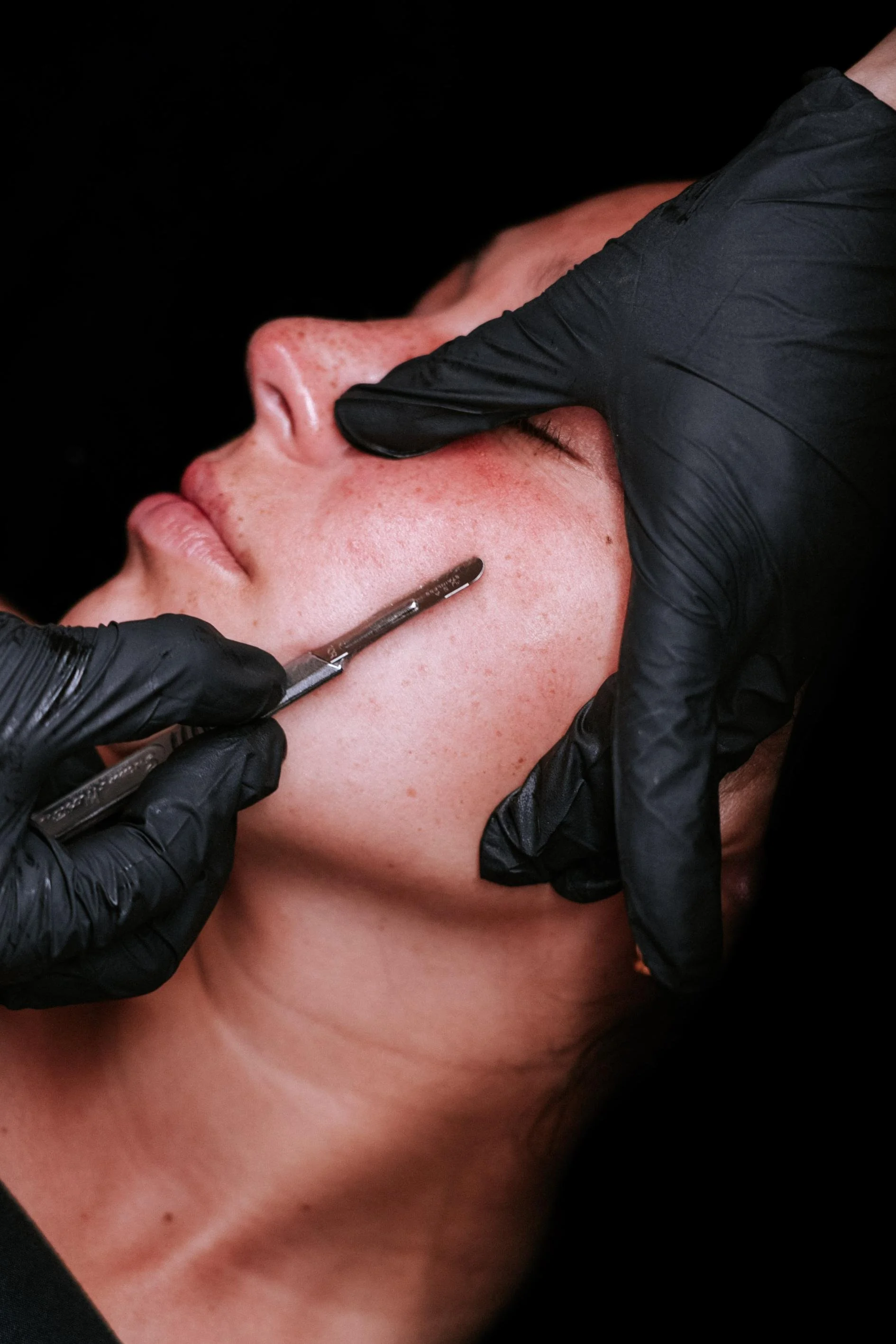 Dermaplane facial in Shrewsbury, NJ
