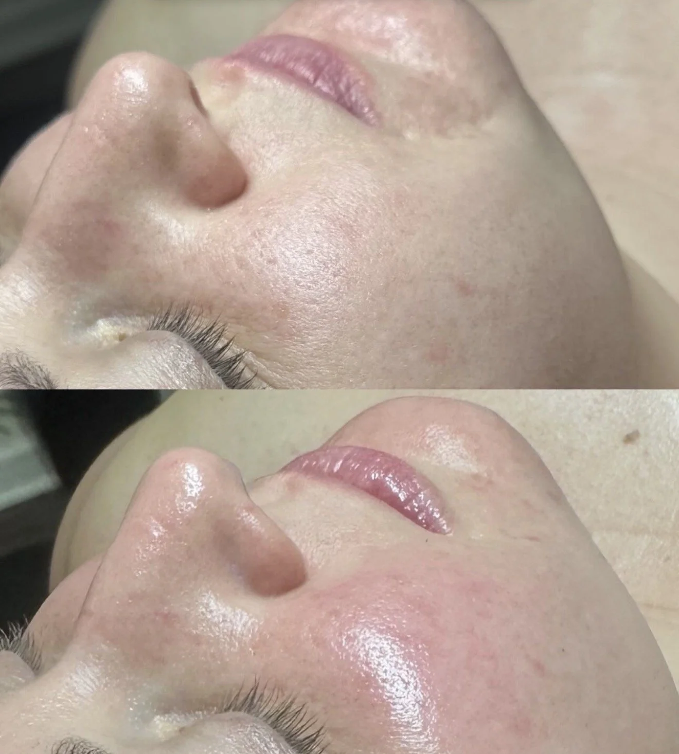 Skincare treatments NJ