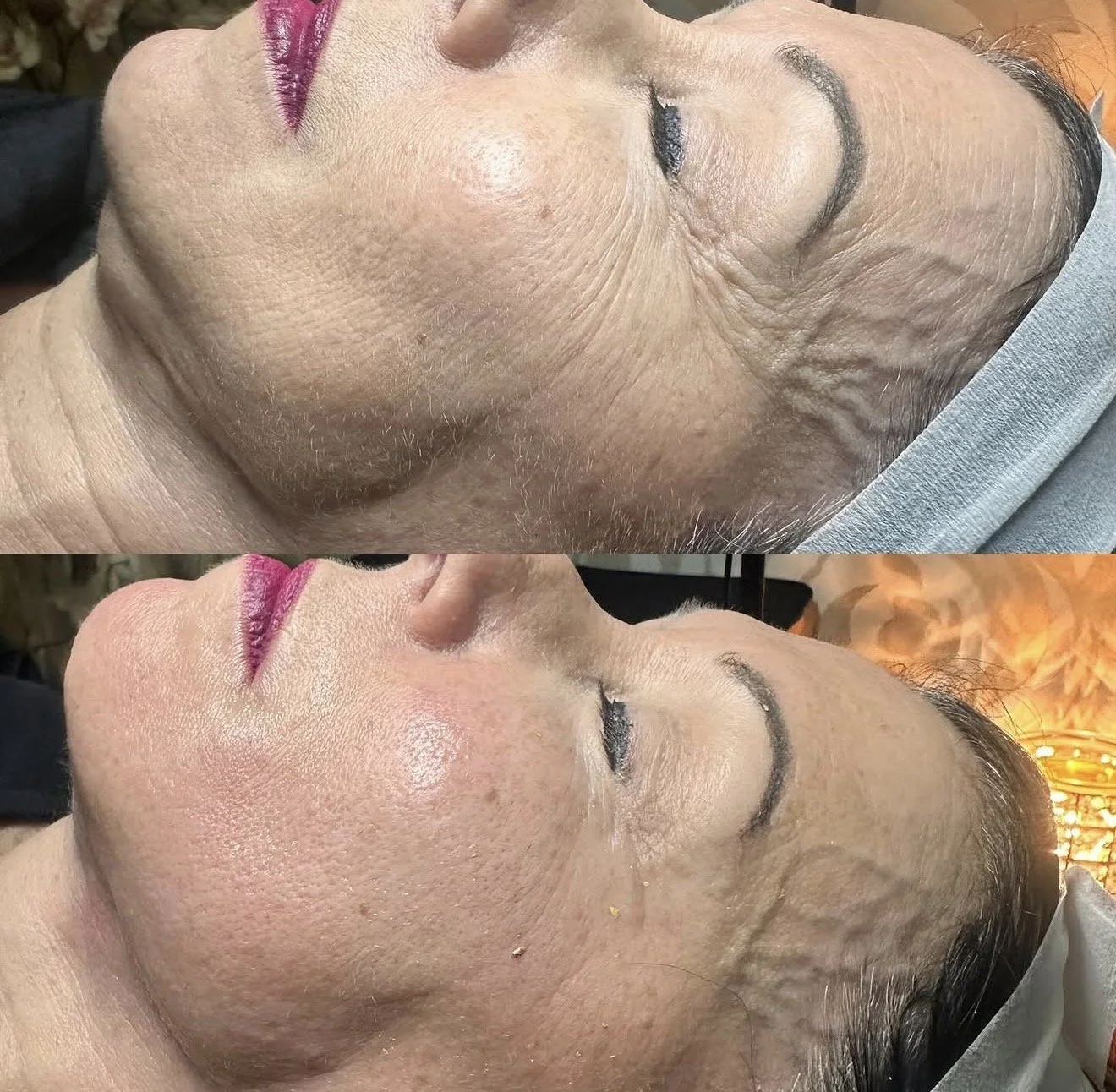 skincare treatments NJ
