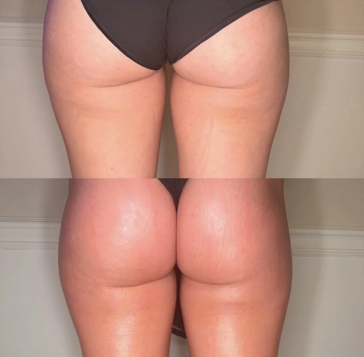 body sculpting spa