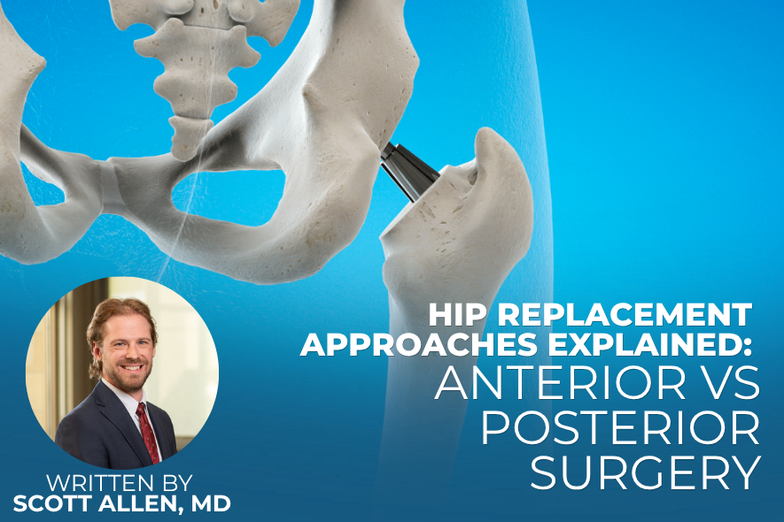 Hip Replacement Approaches Explained: Anterior vs Posterior Surgery