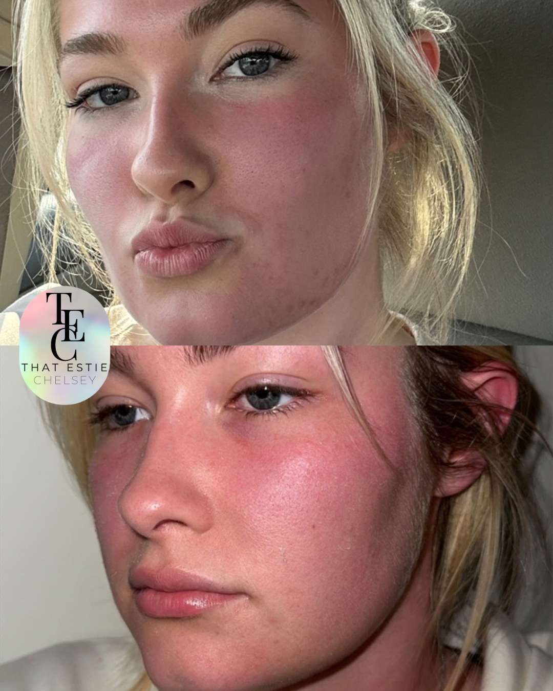 MICROBLADING.png