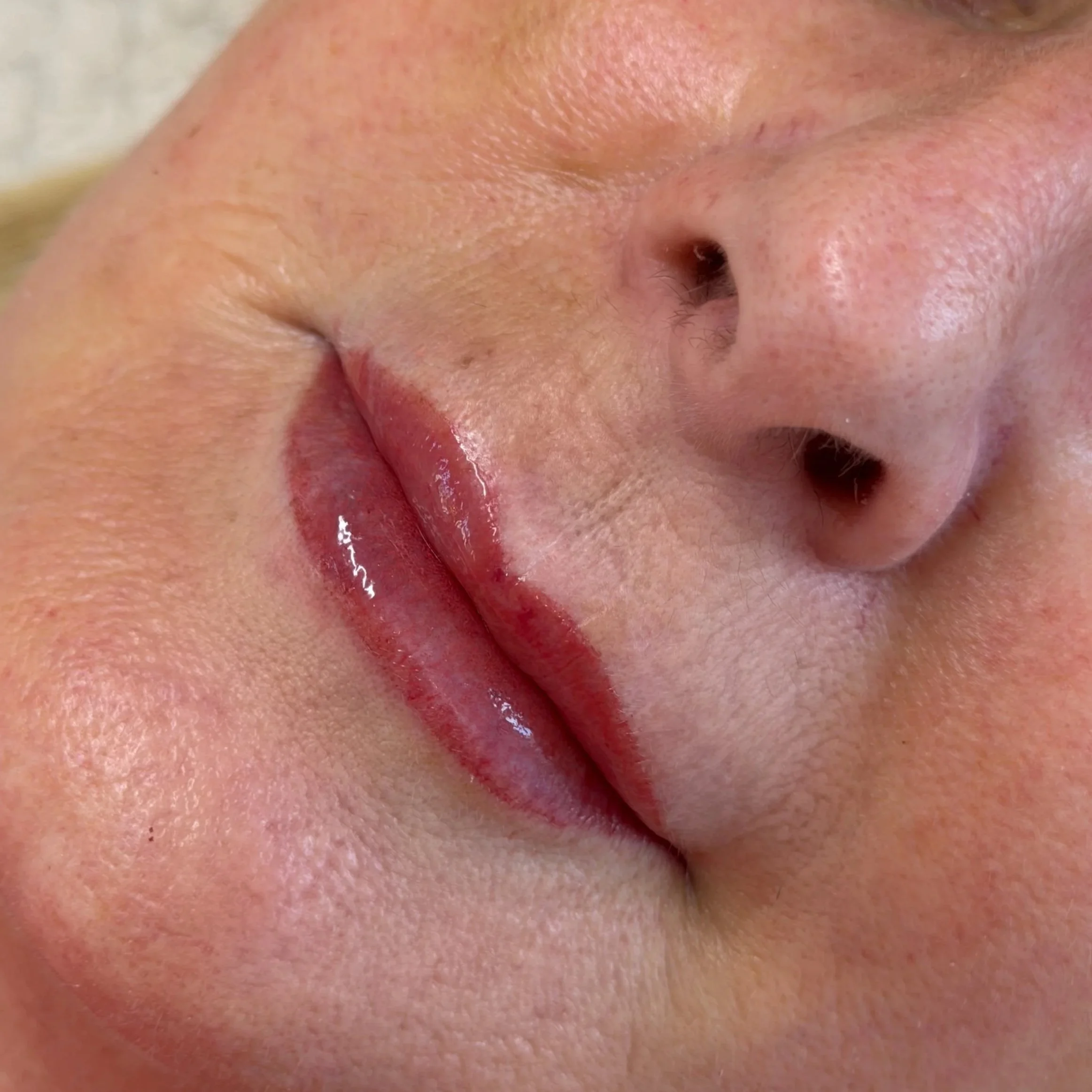Close-up of a person's nose, lips, and surrounding skin, with visible pores and natural skin texture.