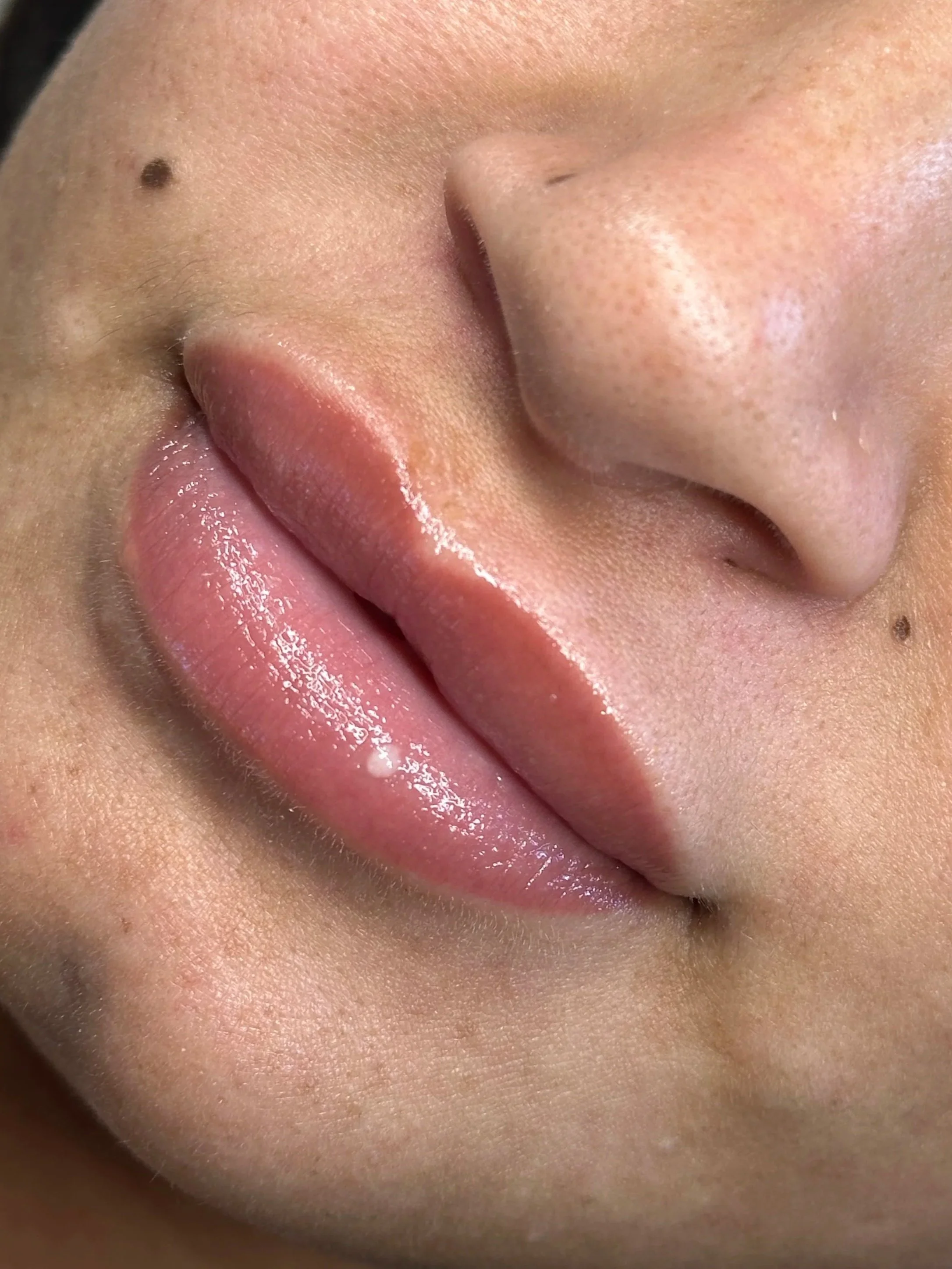 Close-up image of a person's nose and lips showing clear skin and a beauty mole on the upper left cheek.
