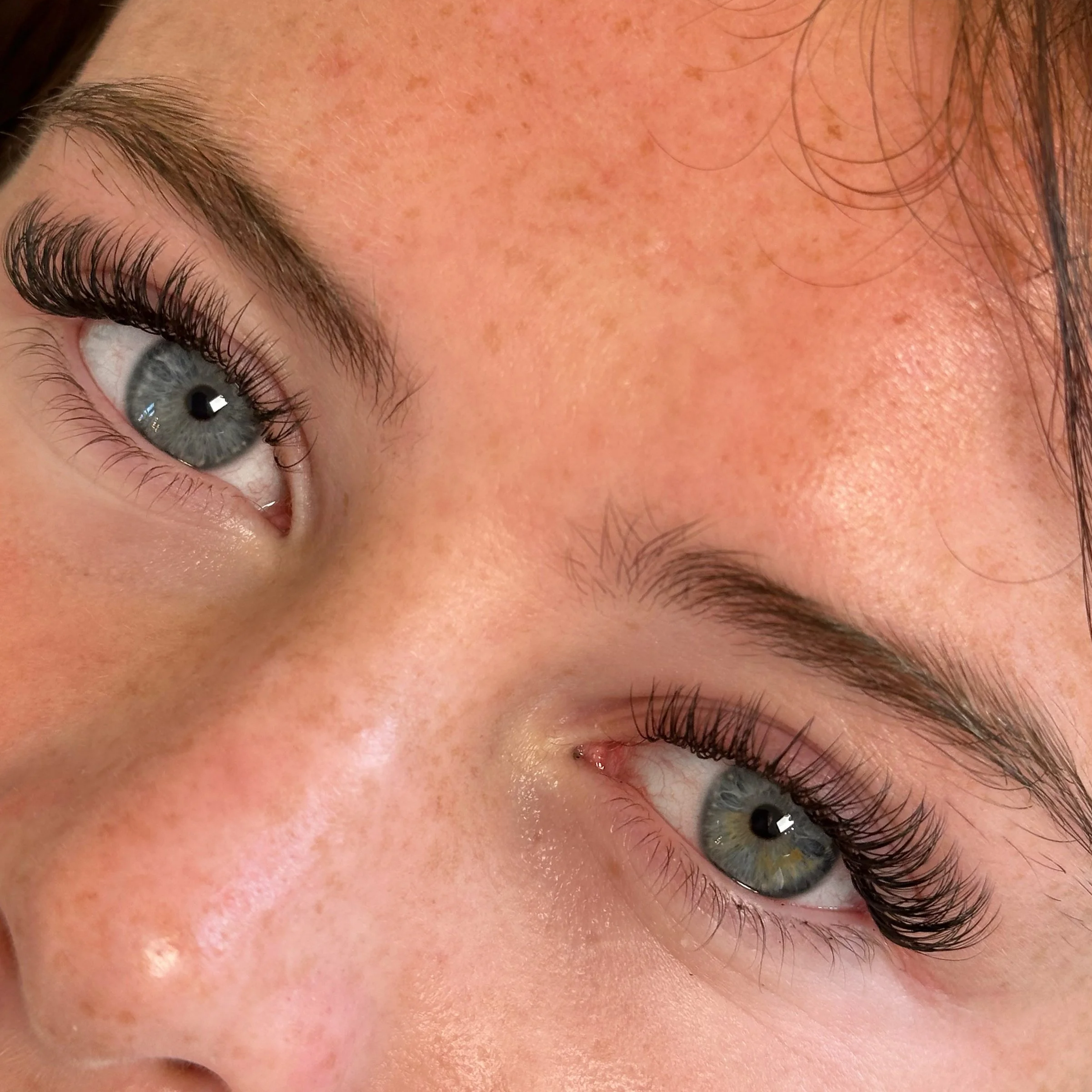 Close-up of a person's eye, eyebrow, and forehead, showing skin with freckles and smooth texture.