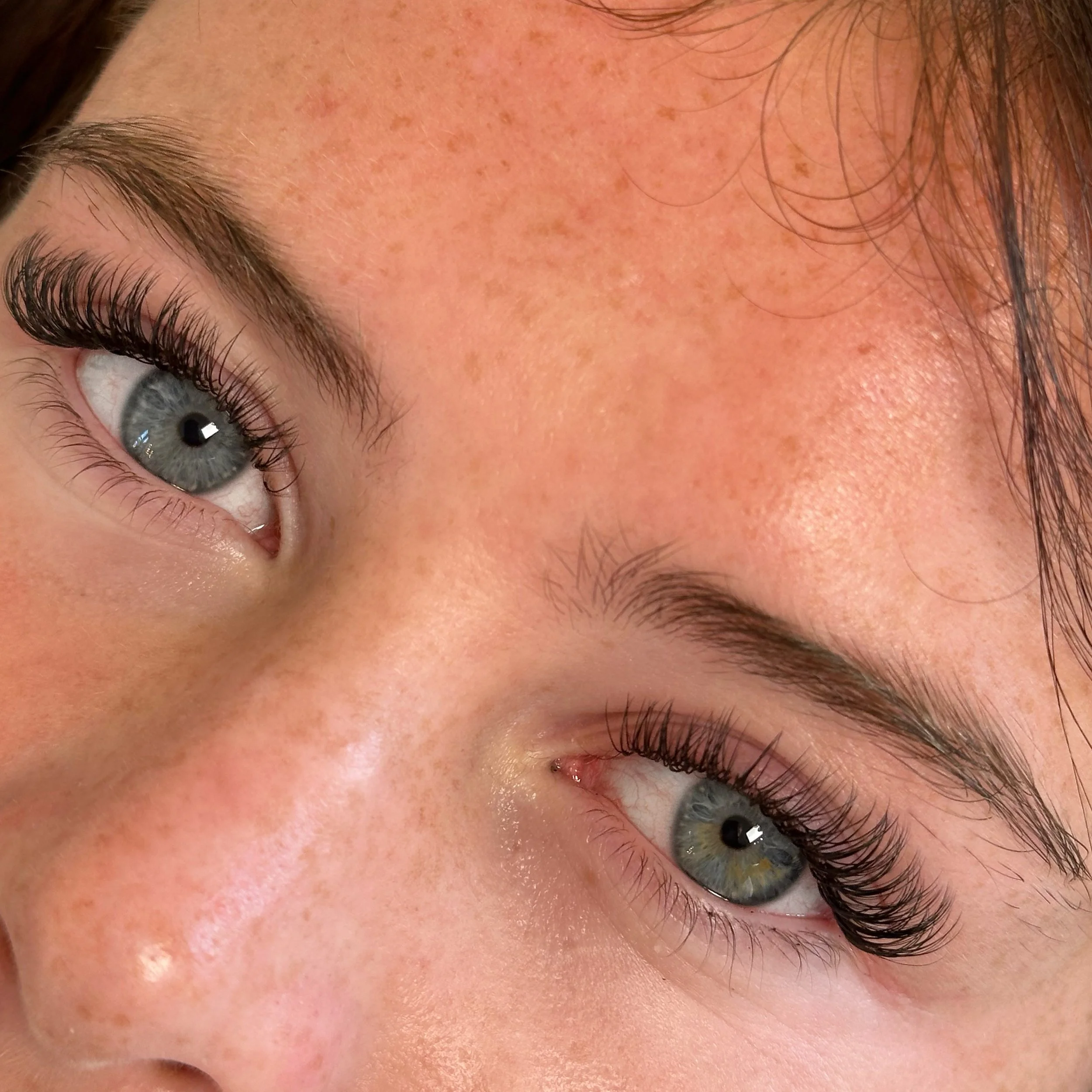 Close-up of a person's eye, eyebrow, and forehead, showing light blue eye and dark eyelashes, with visible skin texture and freckles.