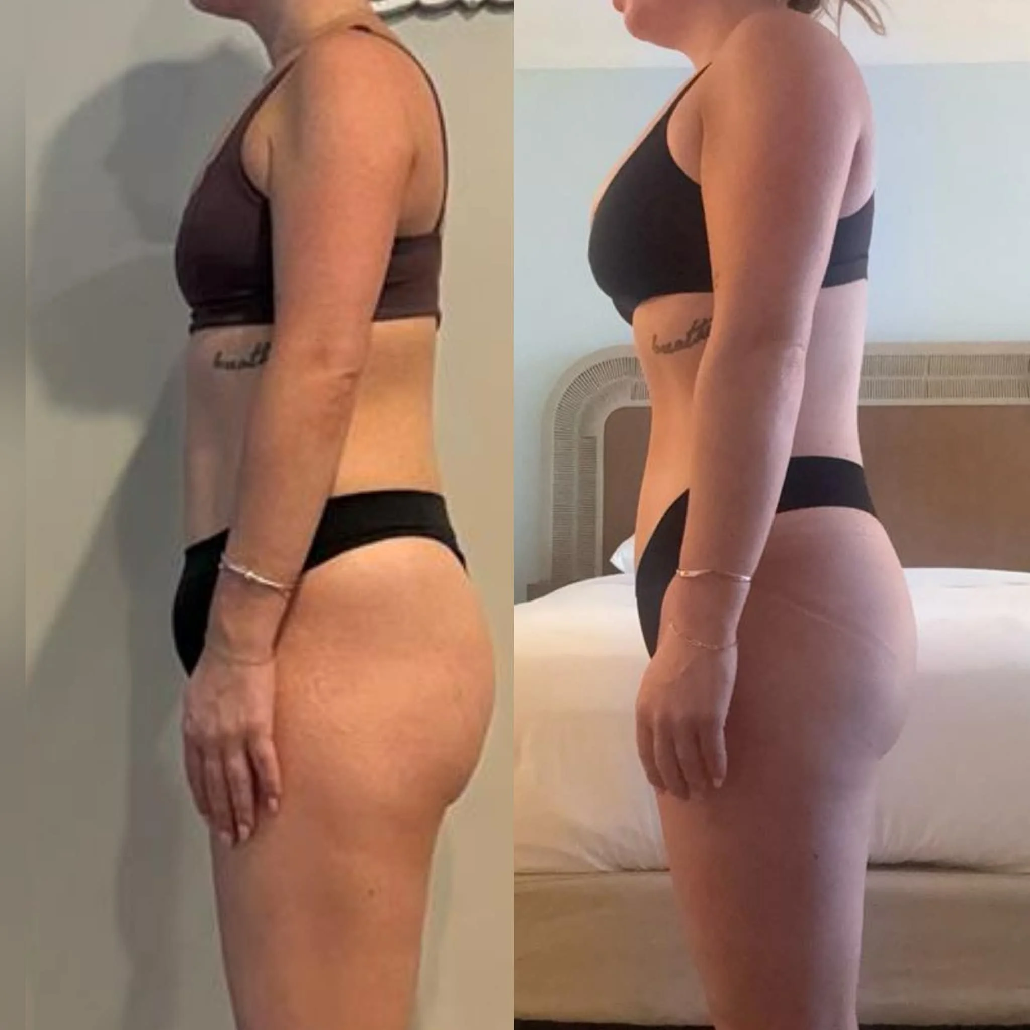 Comparison of a woman’s side profile before and after fitness or weight loss, showing improved body tone and shape.