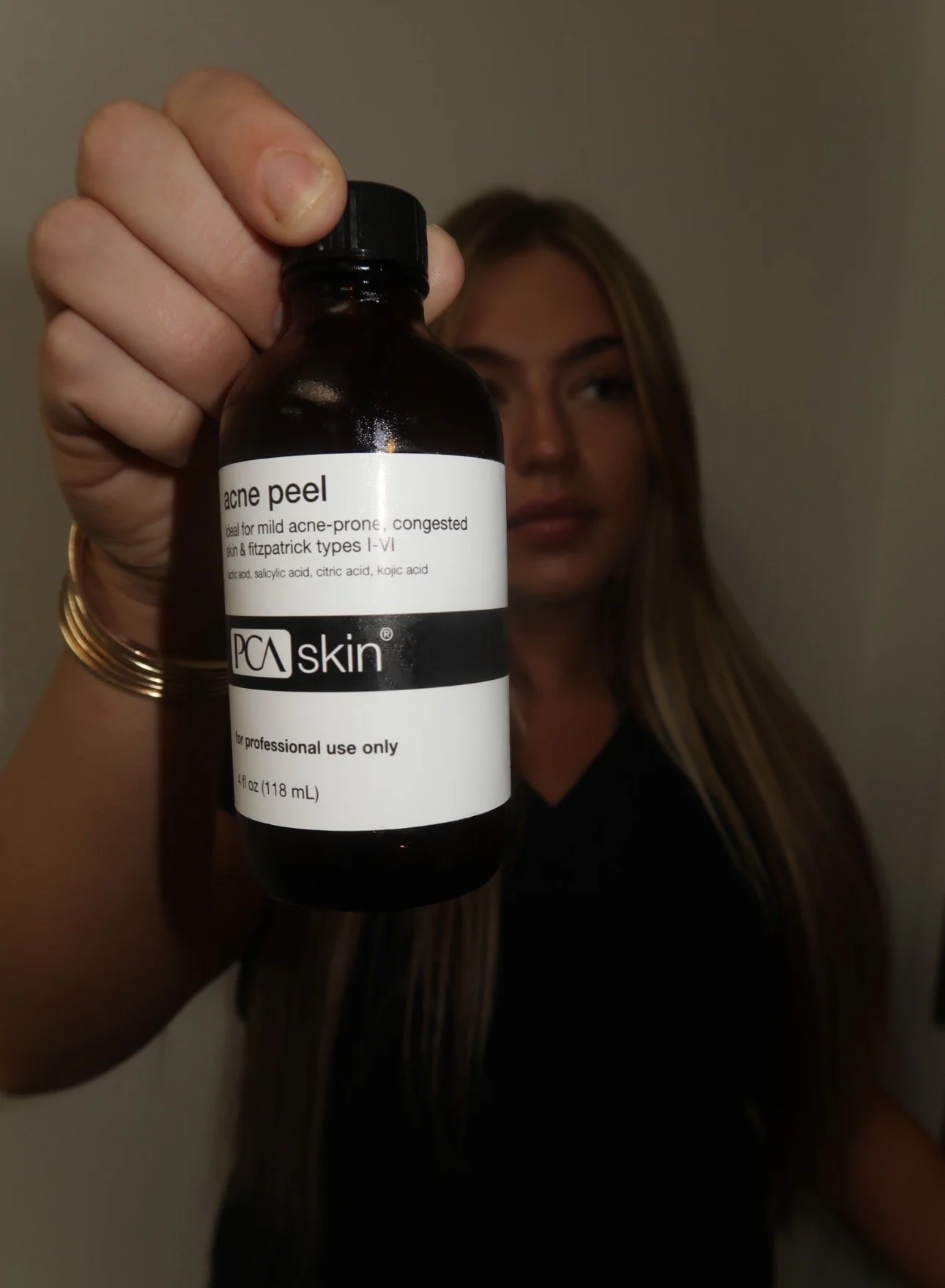 A woman with long hair holding a bottle of PCA skin acne peel close to the camera. The bottle label indicates it is for mild acne-prone, congested skin, for professional use only, containing salicylic acid, citric acid, and kojic acid.
