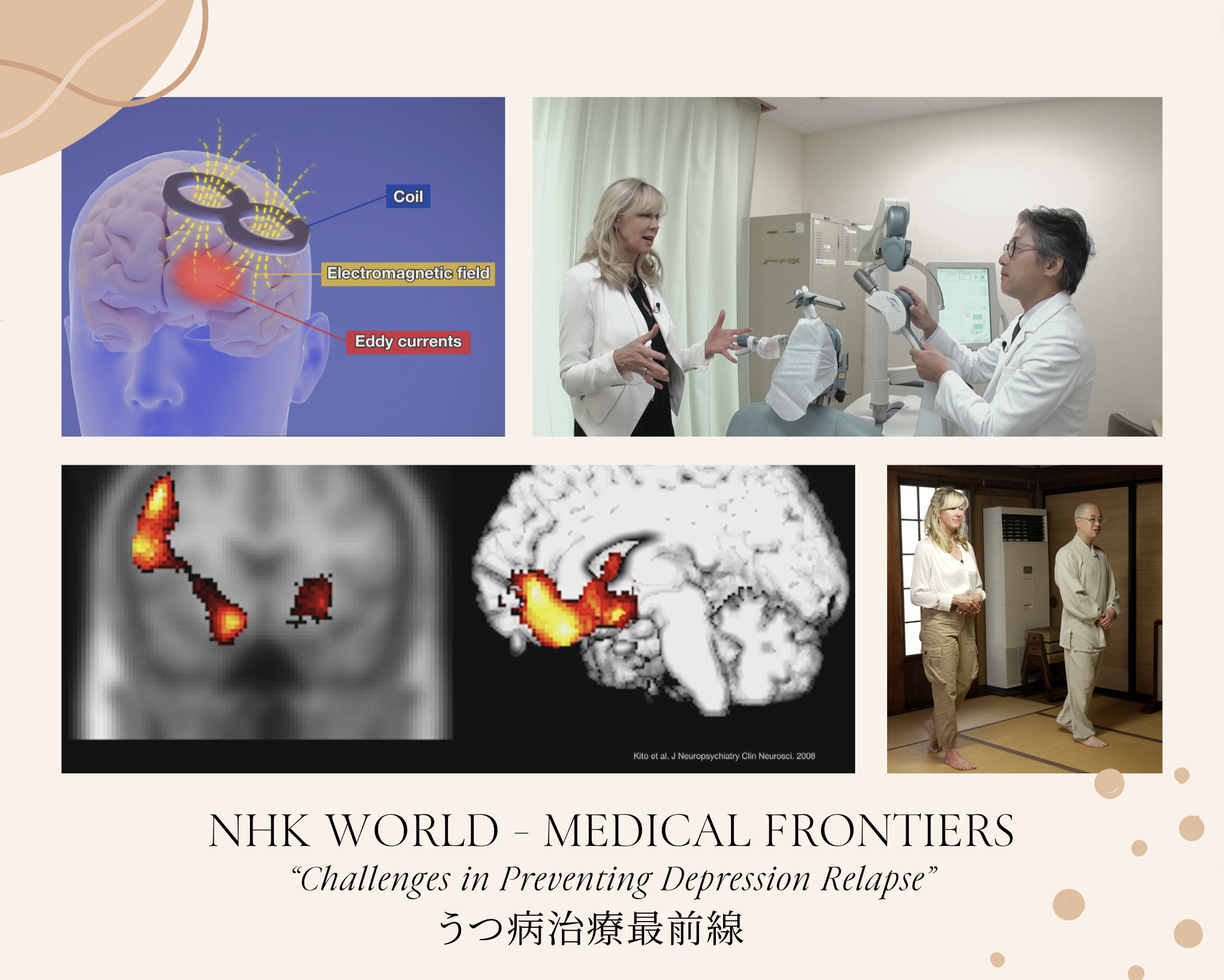 11/13 NHK Medical Frontiers 放送