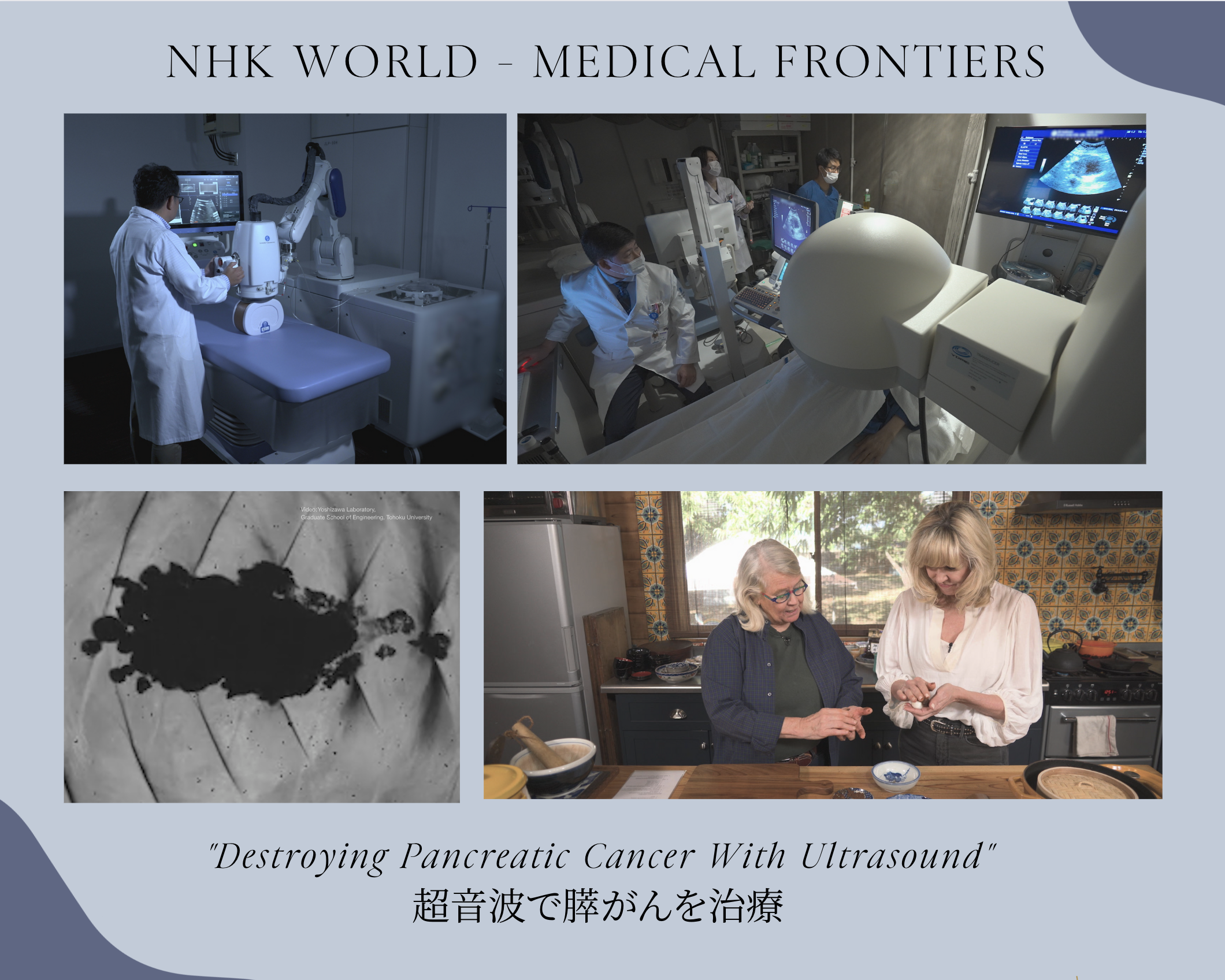 1/8 NHK Medical Frontiers 放送