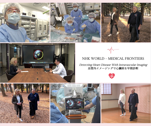2/12 NHK Medical Frontiers 放送