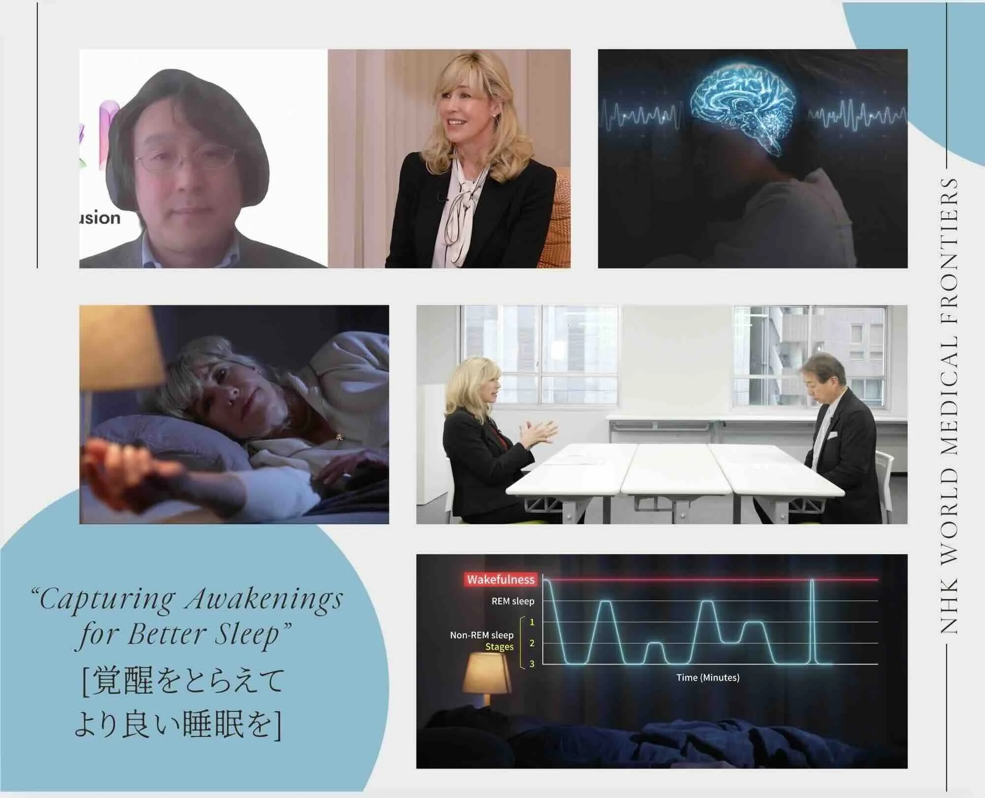 2025/5/19 NHK Medical Frontiers 放送