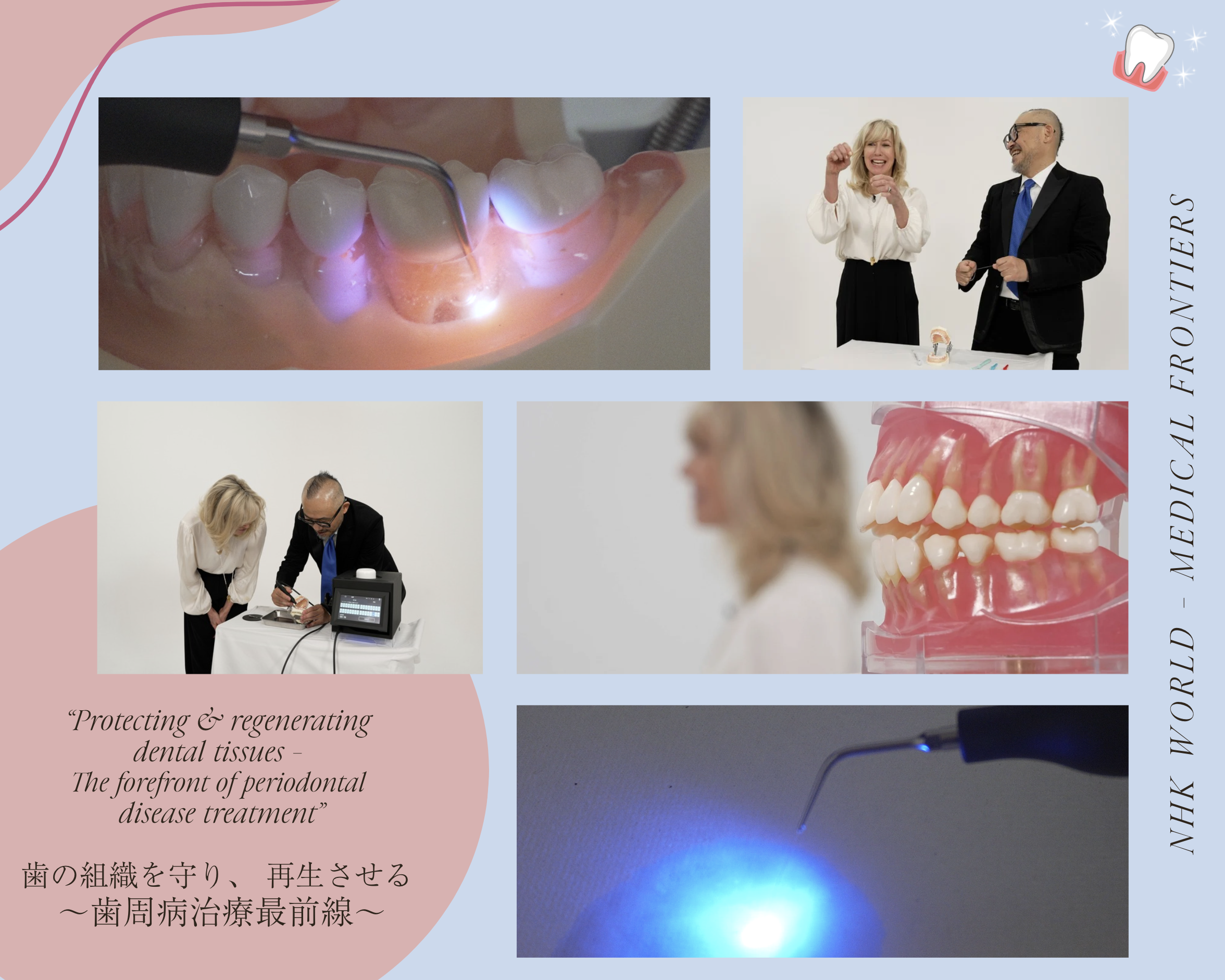 2025年11月24日 NHK WORLD “Medical Frontiers” 放送のお知らせ