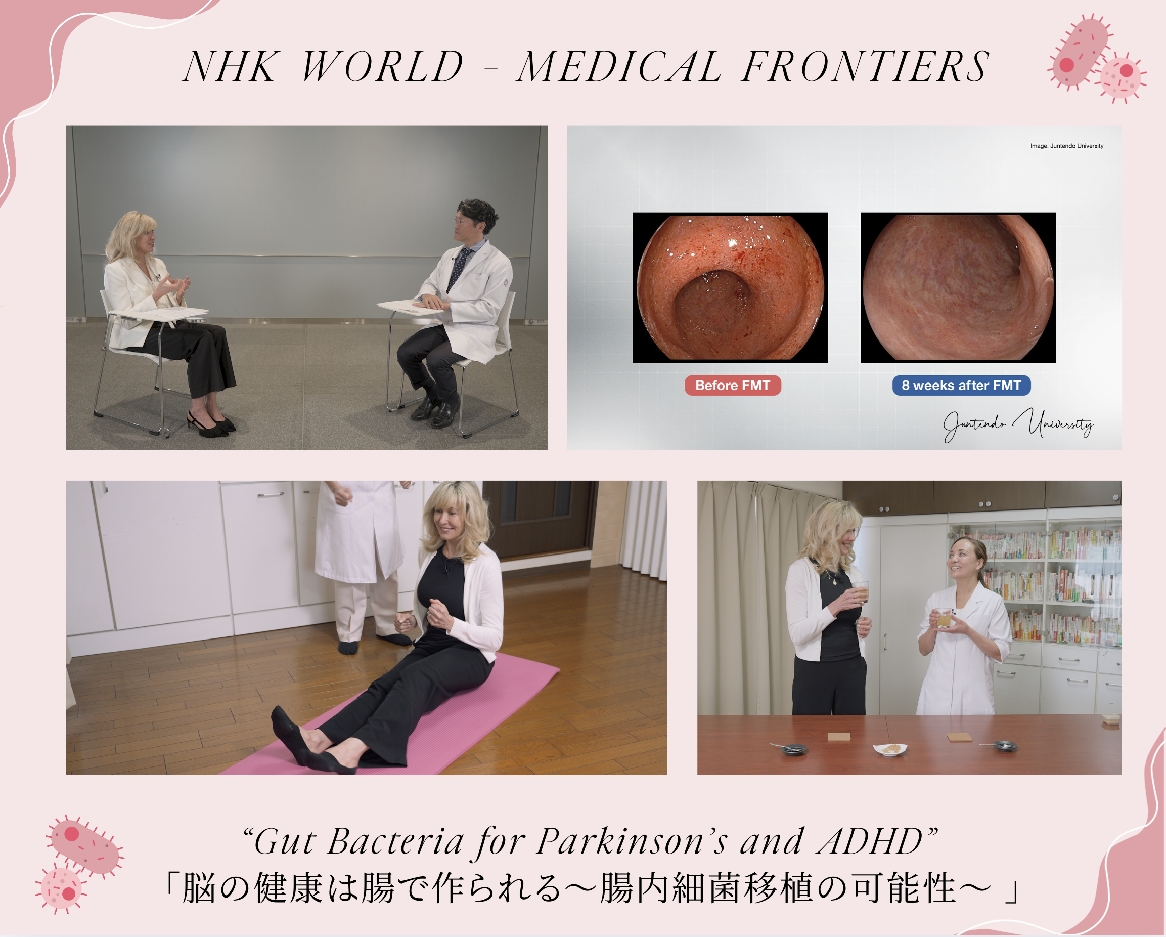 2026年2月23日 NHK WORLD “Medical Frontiers” 放送のお知らせ