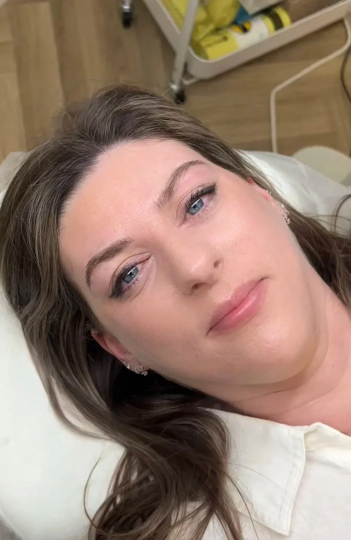 A woman lying on a bed with her head tilted back, showing her face with makeup, brown hair, and earrings in a medical or beauty setting.