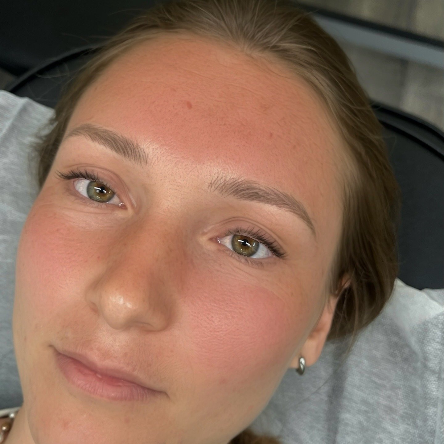 Close-up of a woman's face with a focus on her forehead, eyes, and cheeks, showing natural skin with freckles and light makeup.
