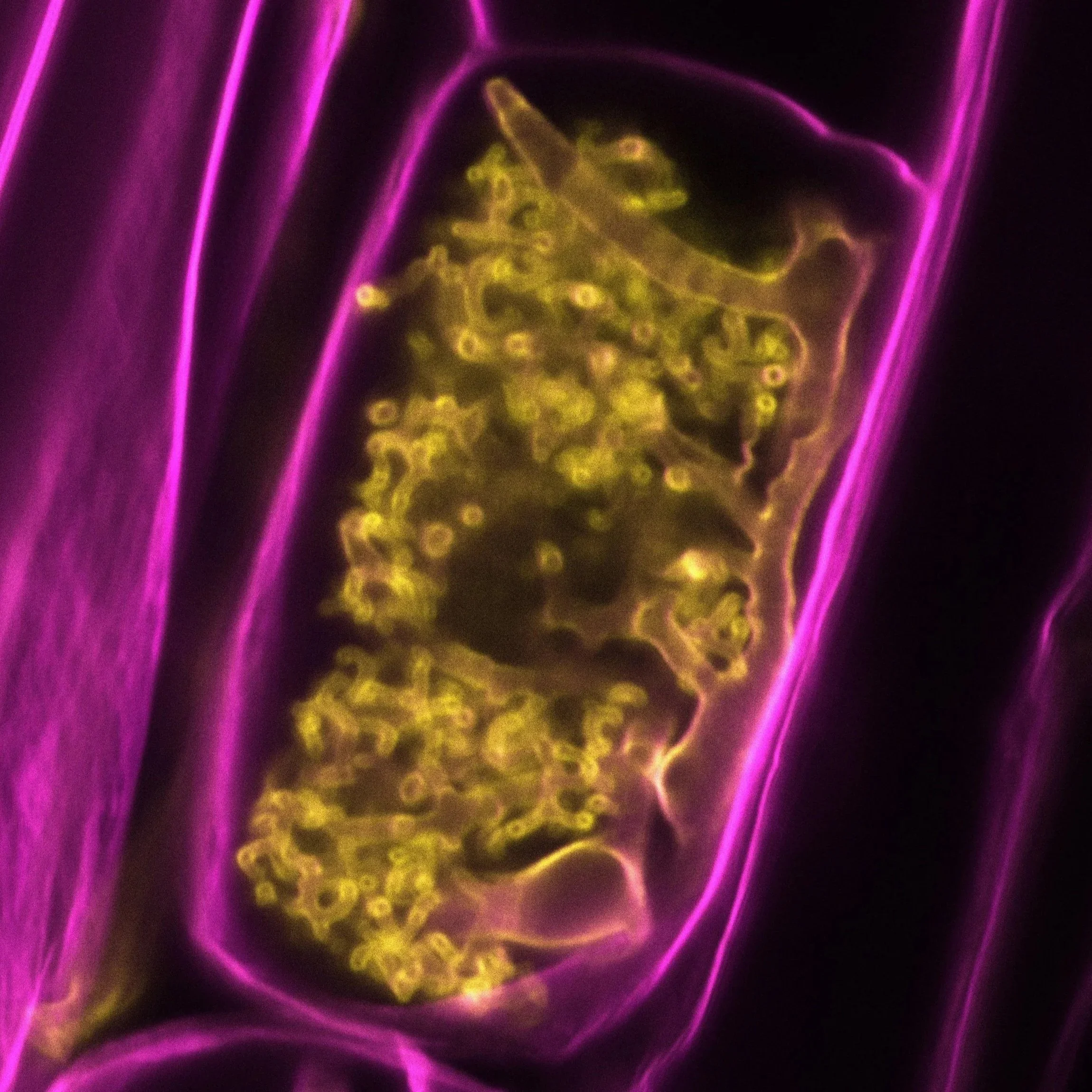 confocal microscopy image of an arbuscule of arbuscular mycorrhizal fungus forming inside a root cell