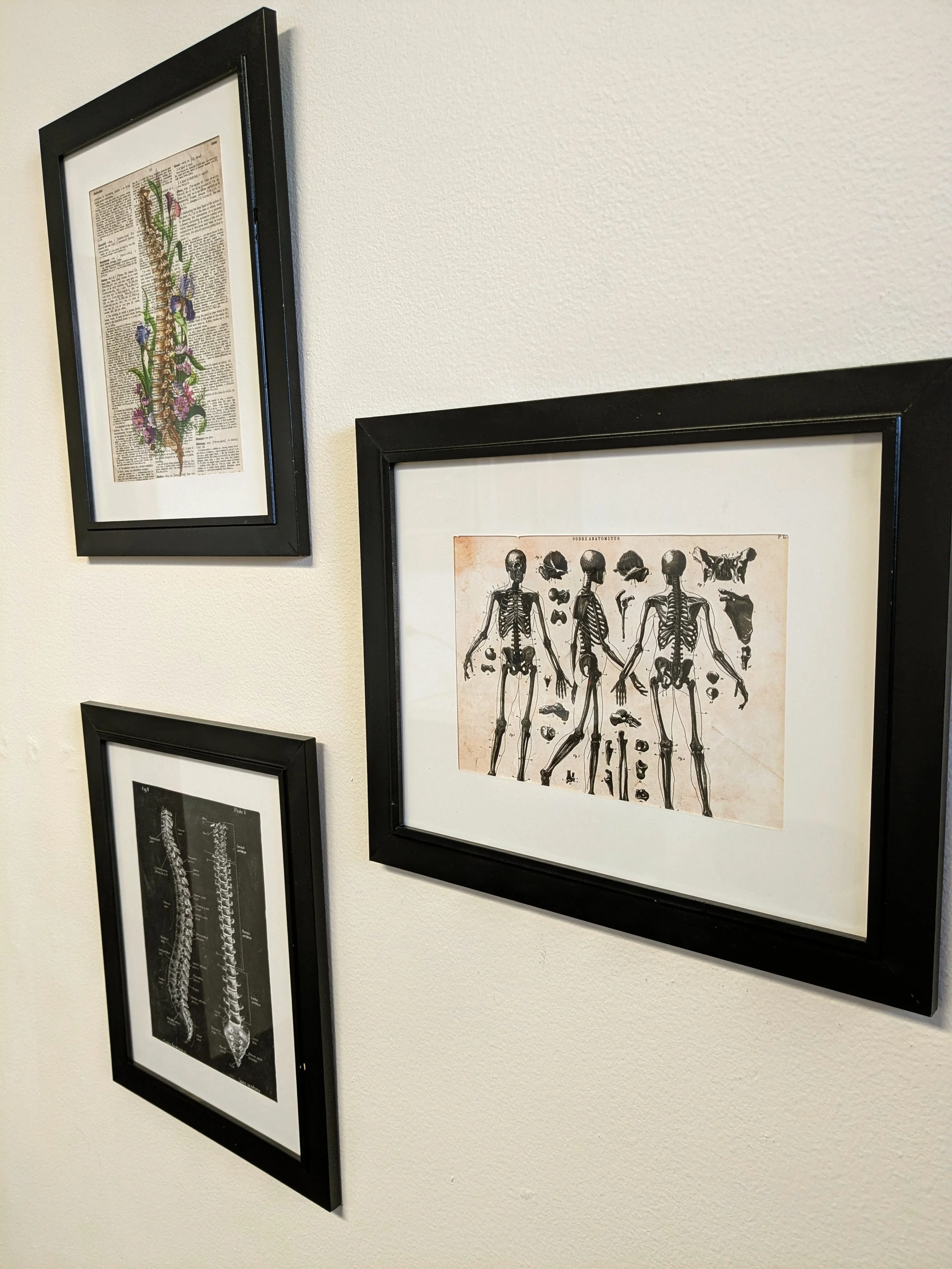 Wall art in one of the treatment room to show off the beauty and importance of your body and spine