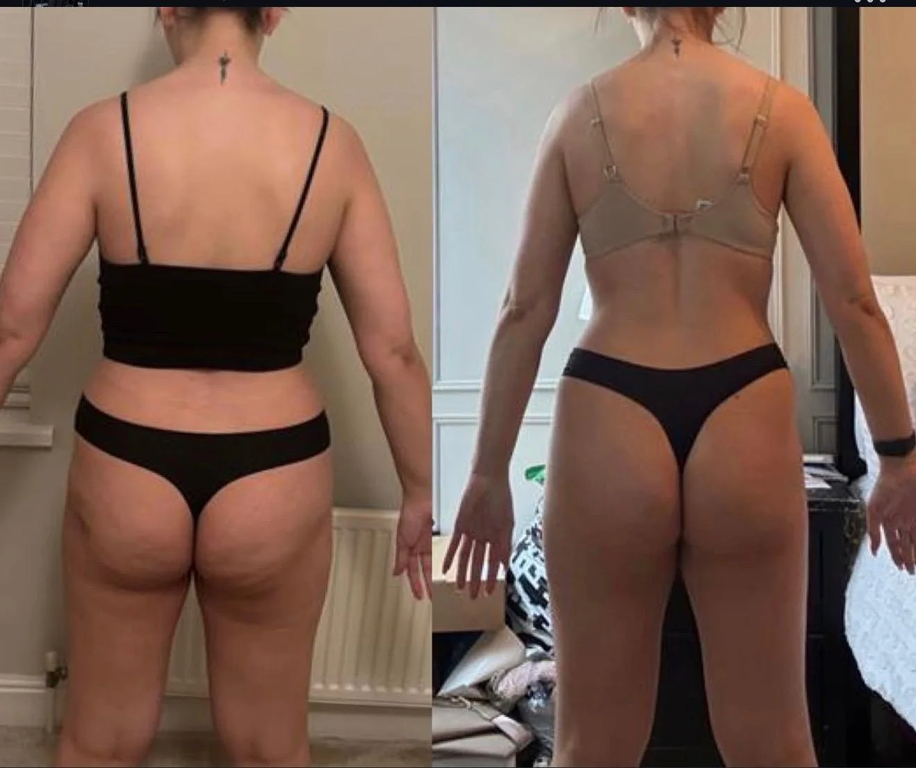 Comparison of a woman's back before and after weight loss or body transformation, showing changes in body shape and muscle tone.