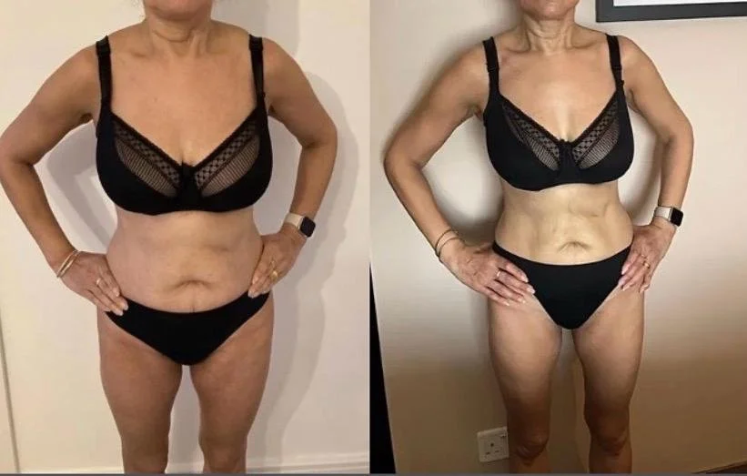 Side-by-side comparison of a woman before and after weight loss