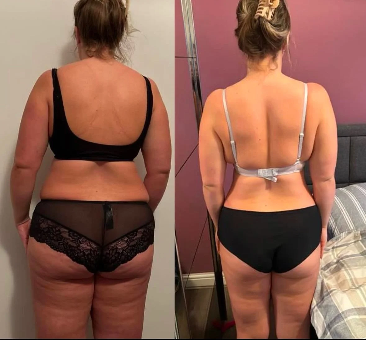 Side-by-side comparison of a woman before and after weight loss, with a notable reduction in body size and improved tone.